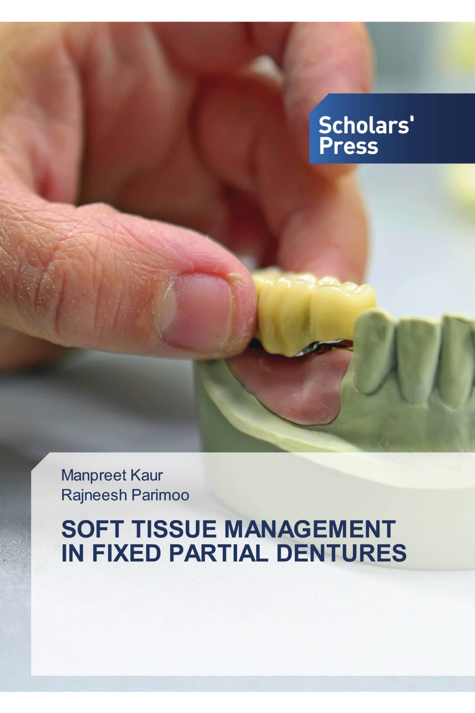 SOFT TISSUE MANAGEMENT IN FIXED PARTIAL DENTURES