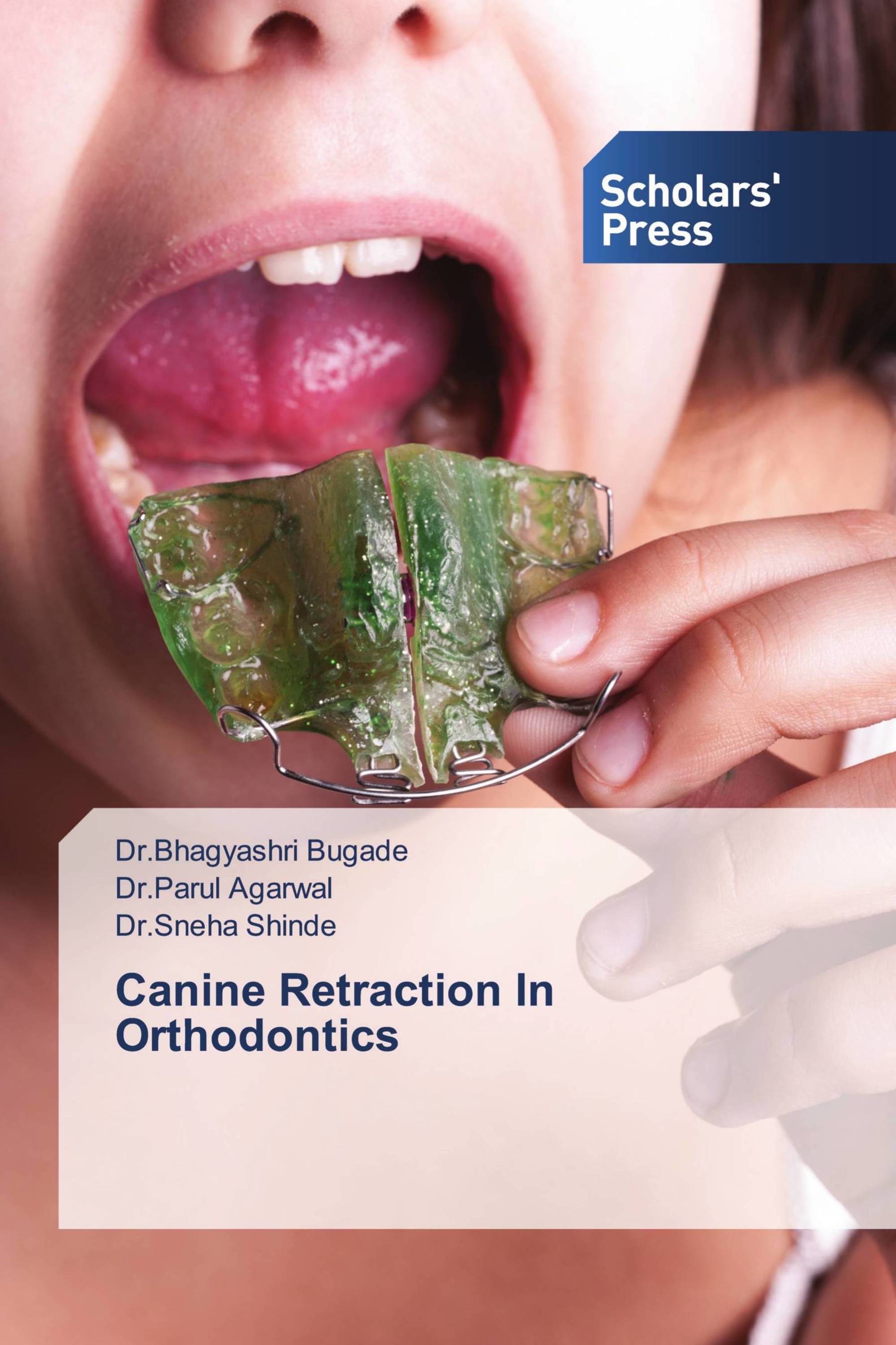 Canine Retraction In Orthodontics