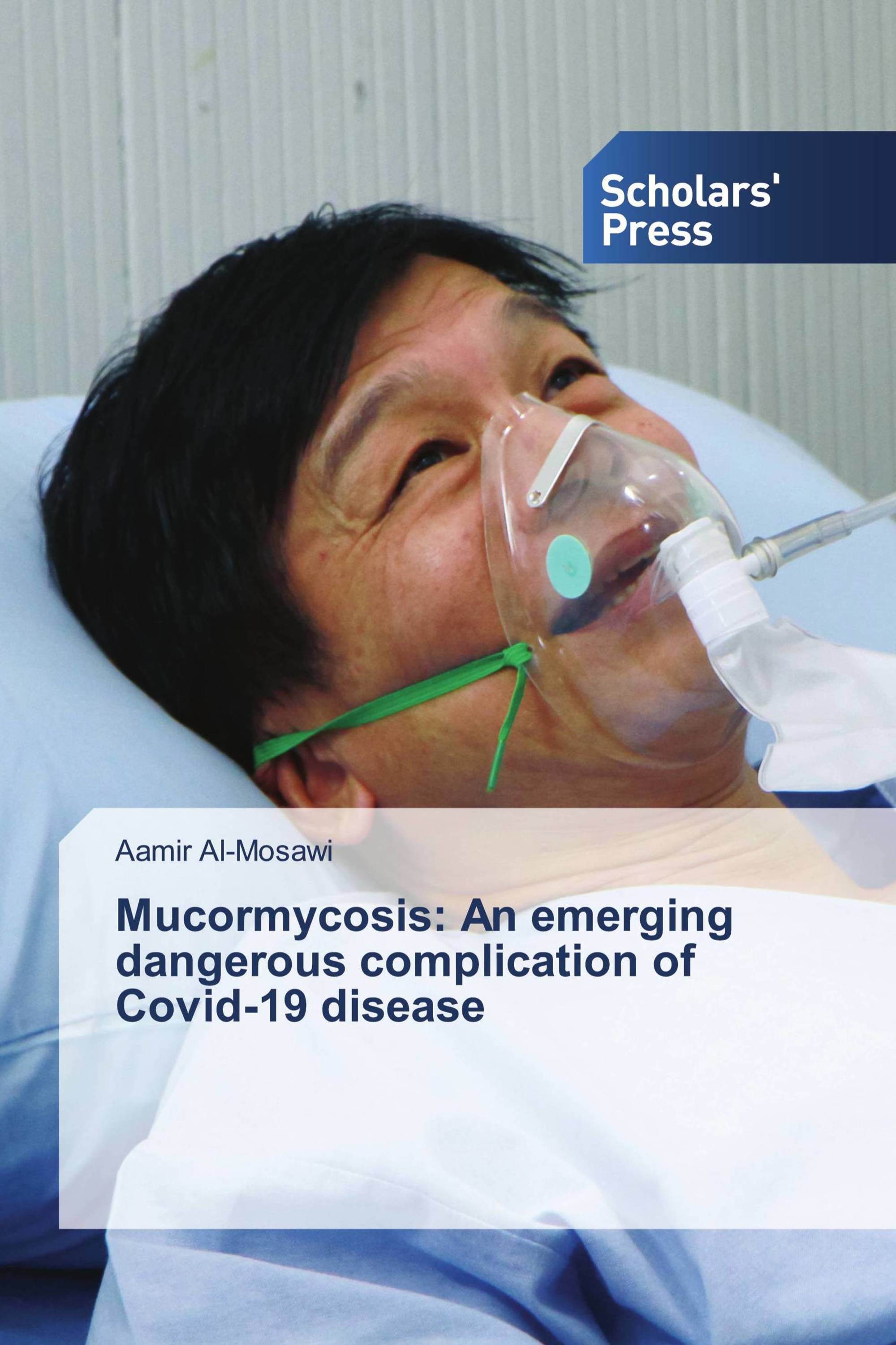 Mucormycosis: An emerging dangerous complication of Covid-19 disease