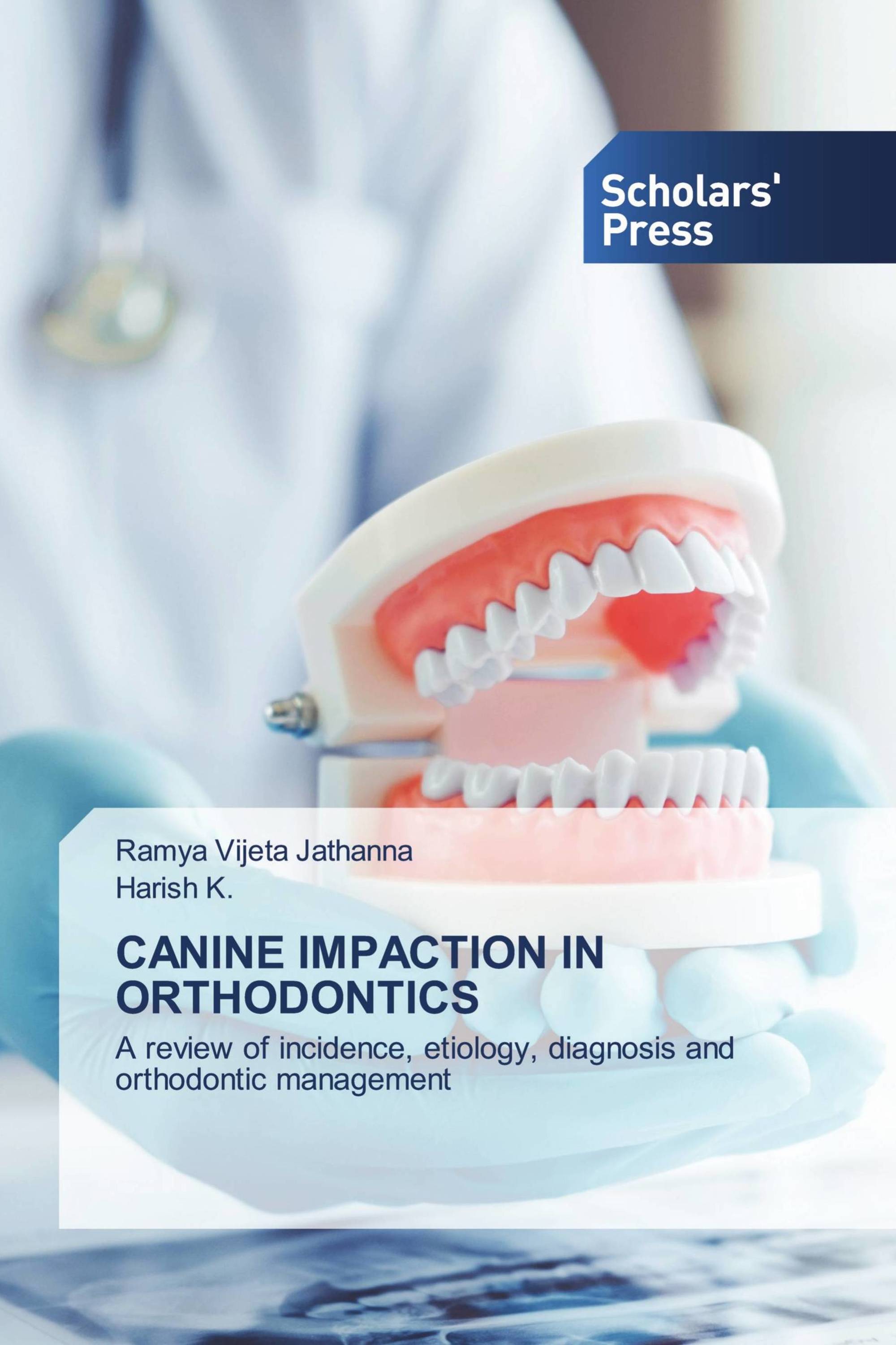 CANINE IMPACTION IN ORTHODONTICS