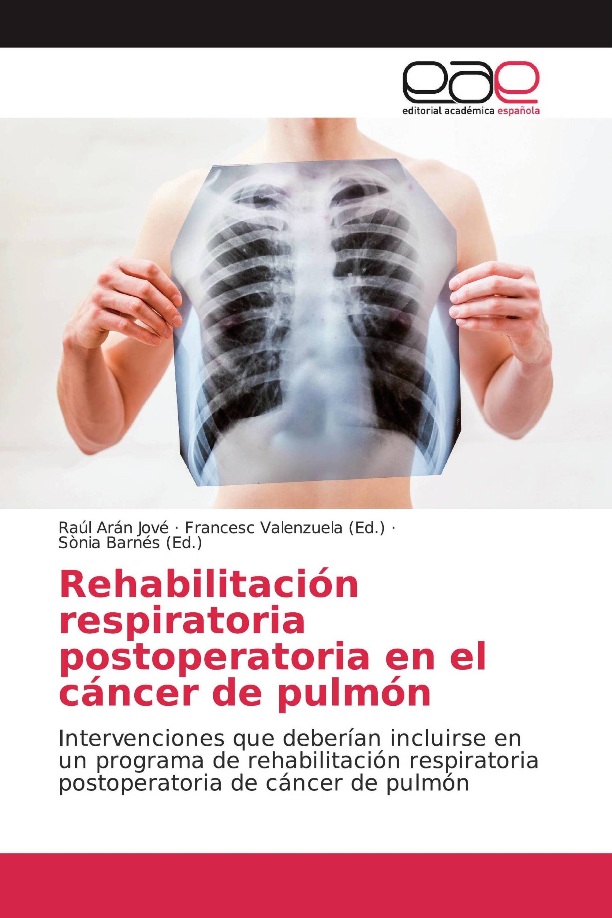 Rehabilitación respiratoria postoperatoria en el cáncer de pulmón