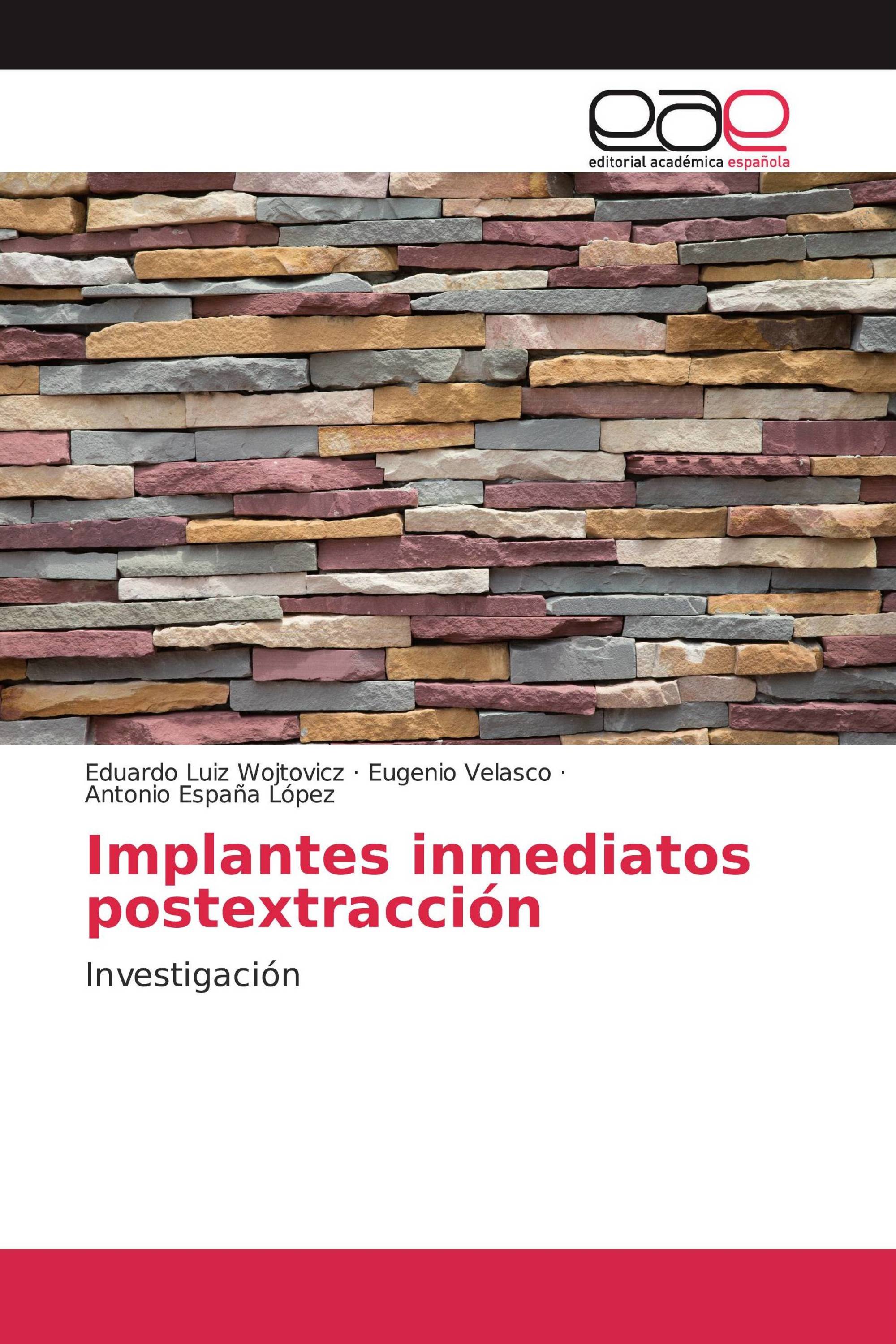 Implantes inmediatos postextracción