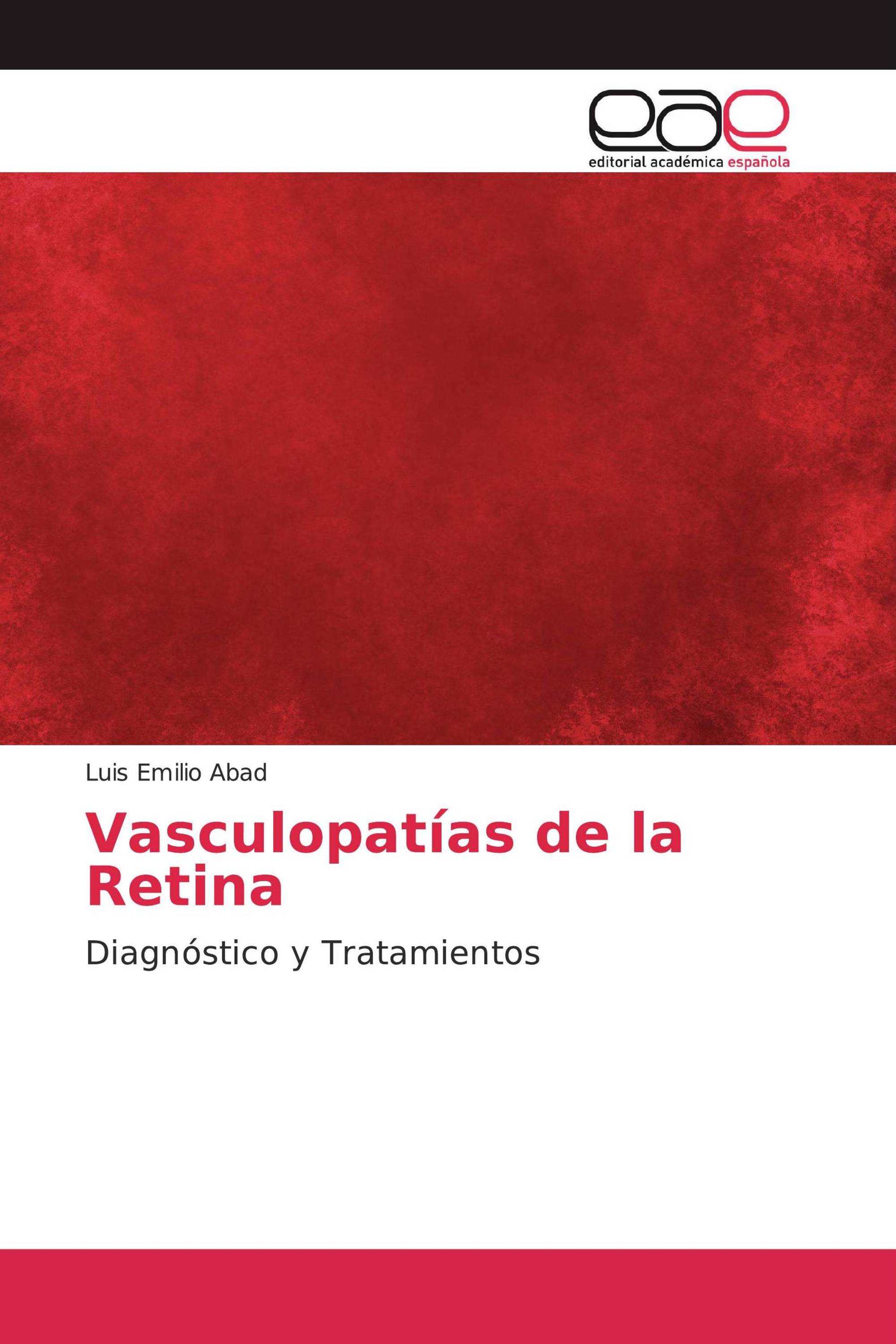 Vasculopatías de la Retina