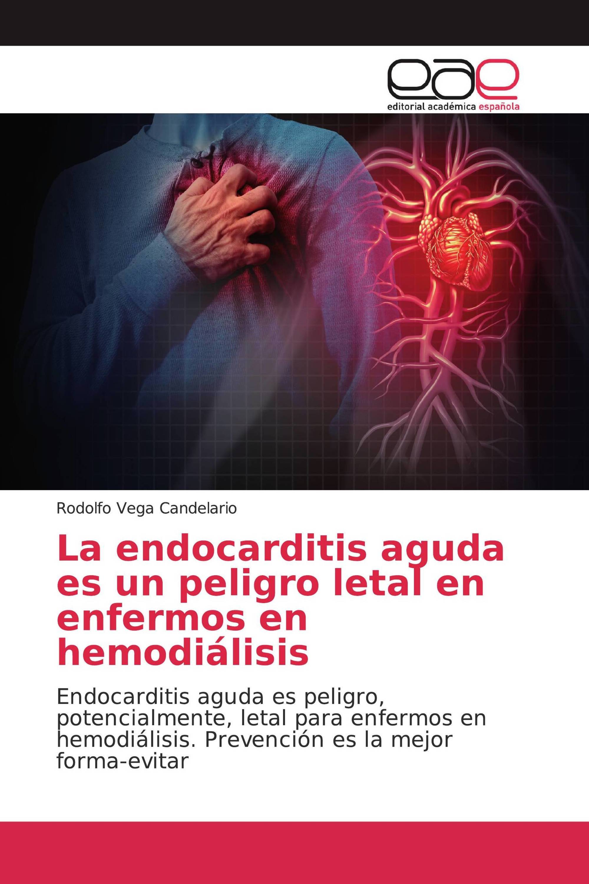 La endocarditis aguda es un peligro letal en enfermos en hemodiálisis