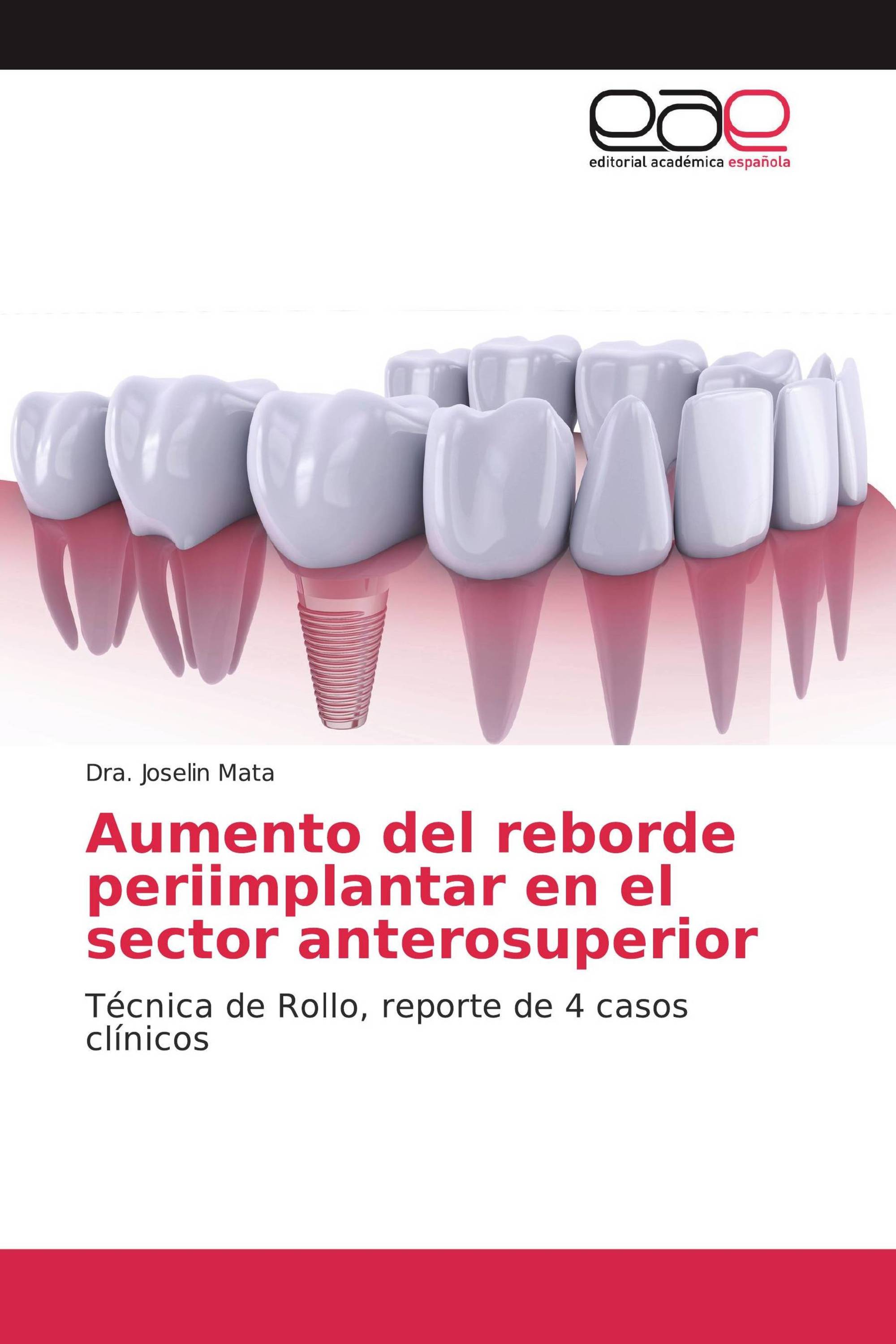 Aumento del reborde periimplantar en el sector anterosuperior