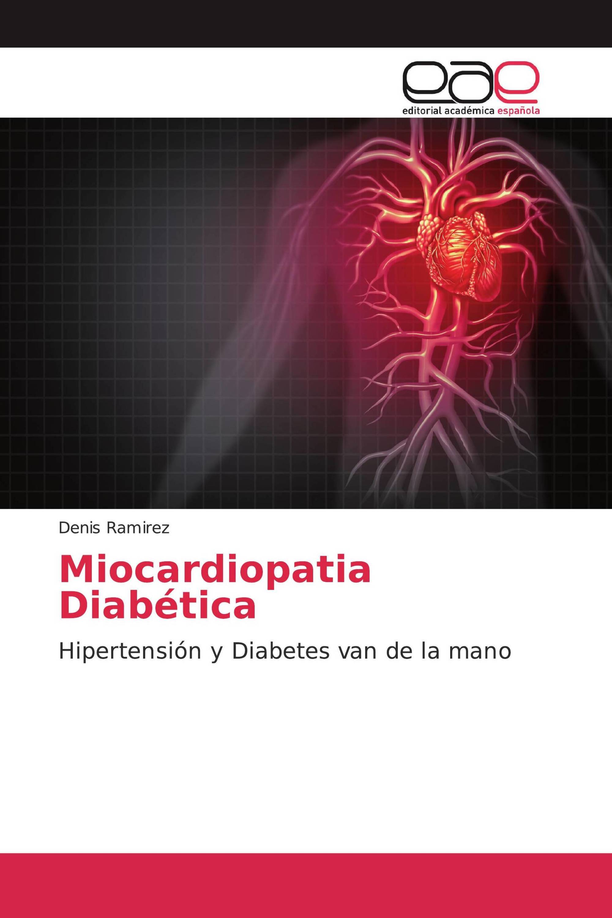 Miocardiopatia Diabética