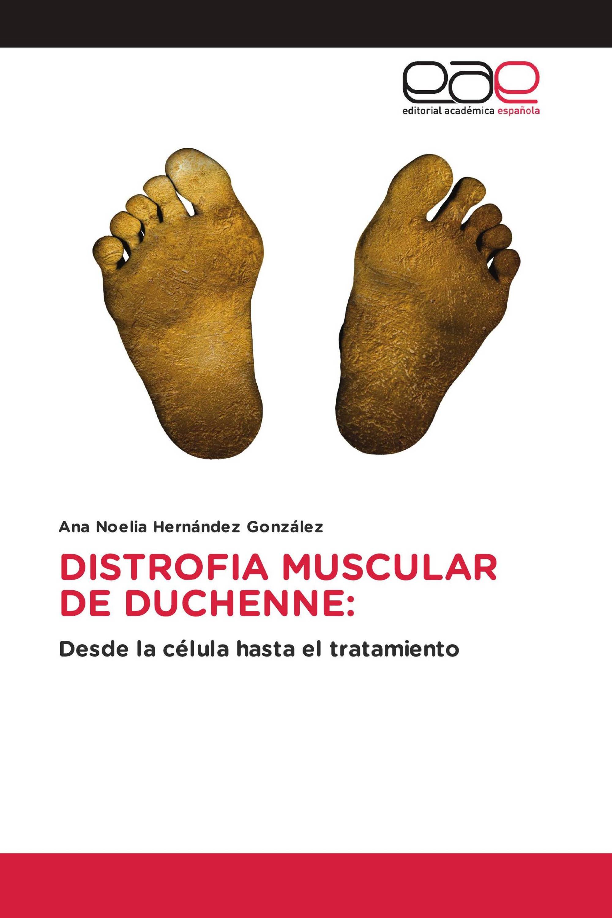 DISTROFIA MUSCULAR DE DUCHENNE: