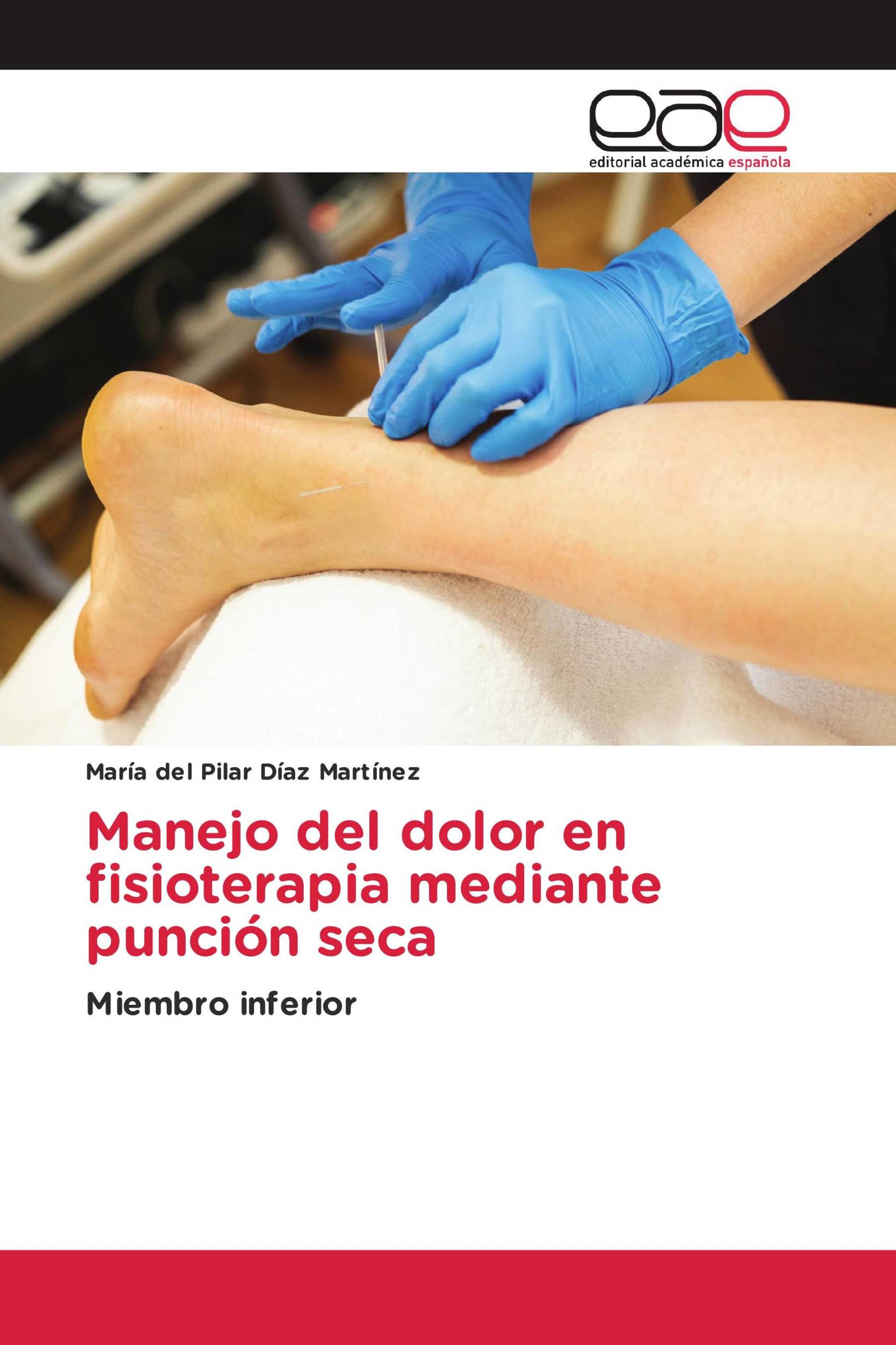 Manejo del dolor en fisioterapia mediante punción seca