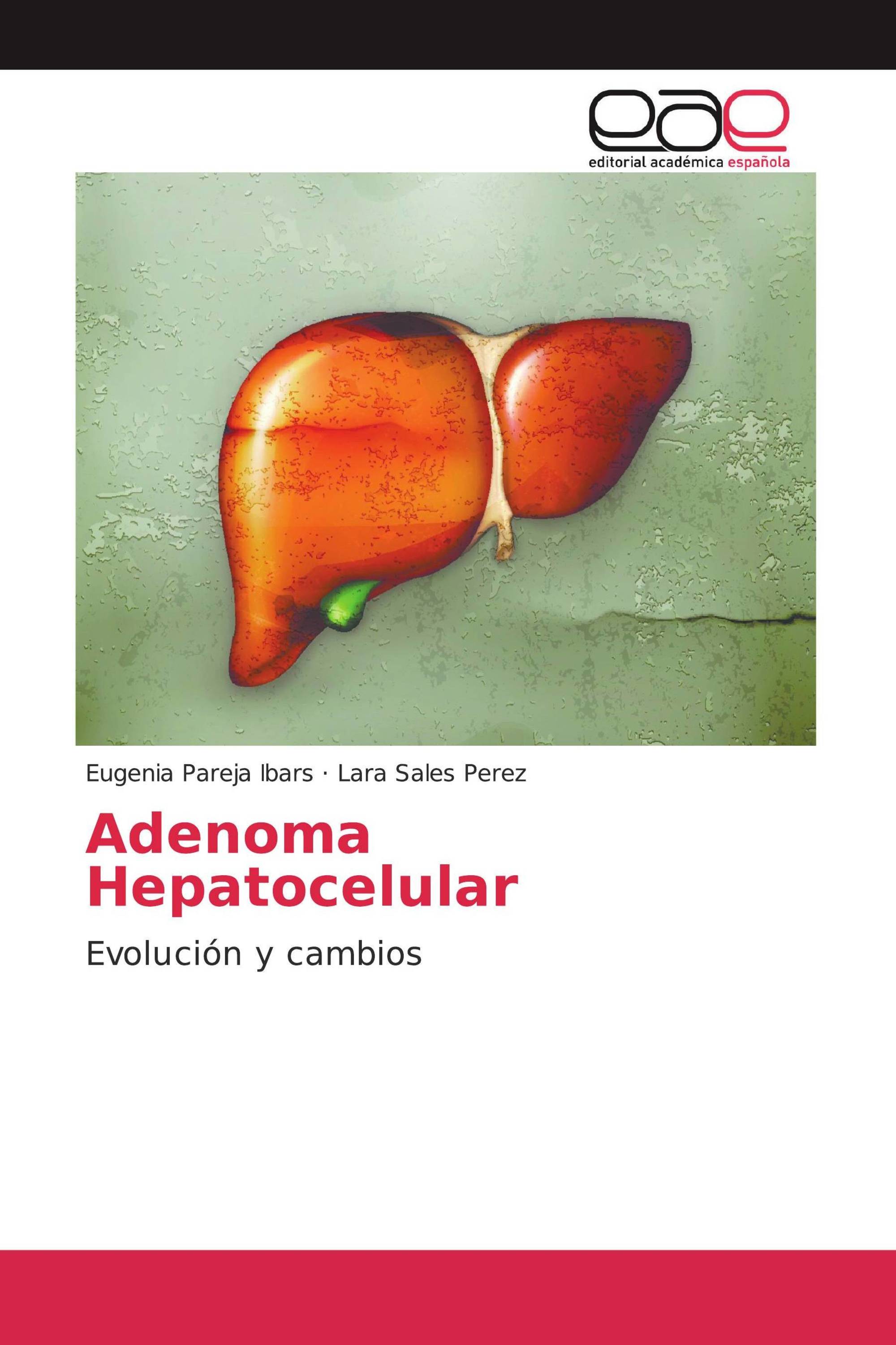 Adenoma Hepatocelular