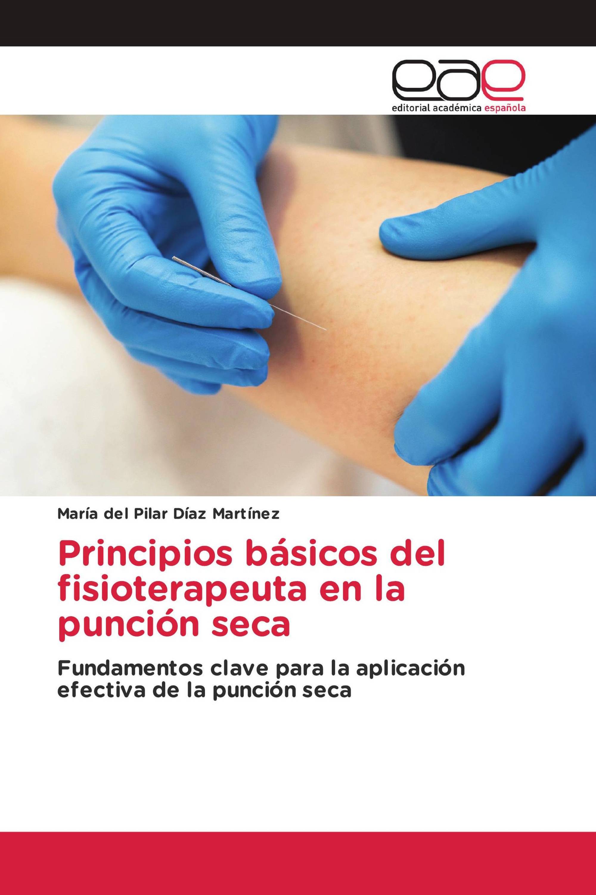 Principios básicos del fisioterapeuta en la punción seca