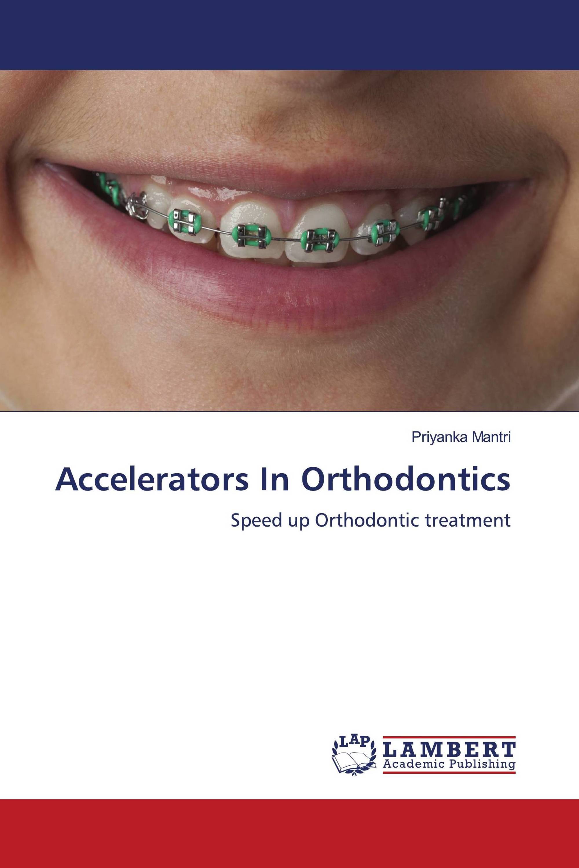 Accelerators In Orthodontics