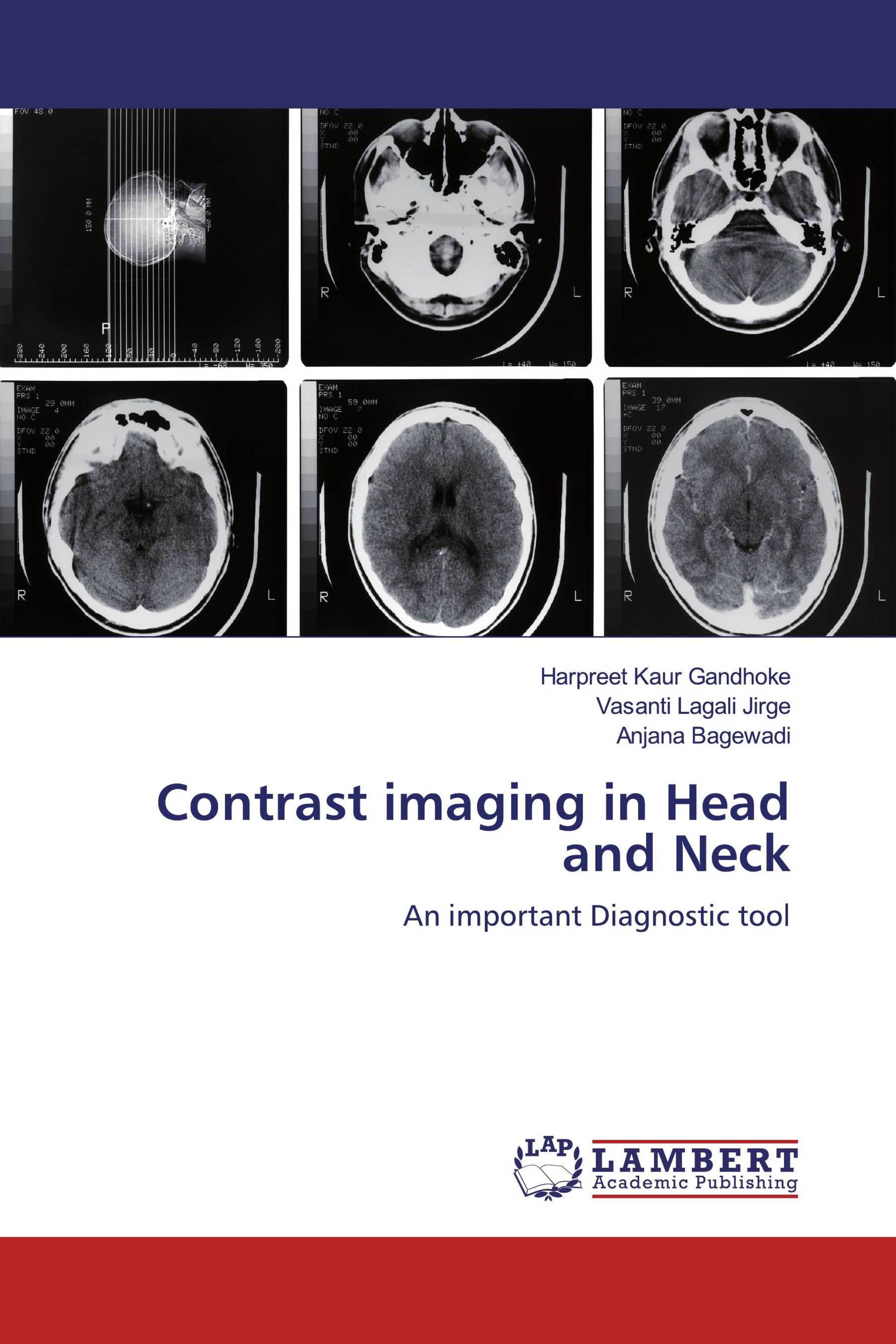 Contrast imaging in Head and Neck / 9786139461752 / 9786139461752