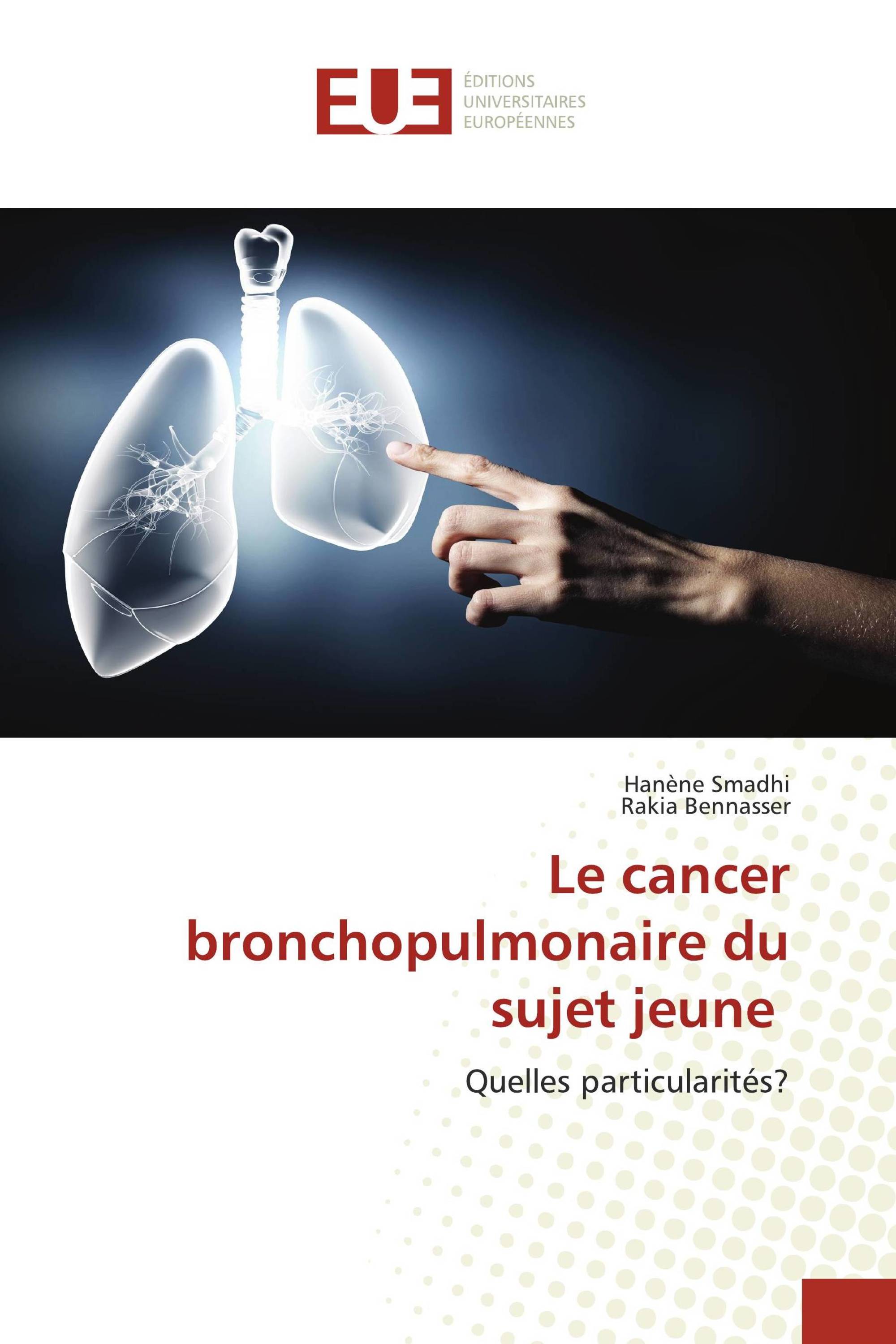 Le cancer bronchopulmonaire du sujet jeune