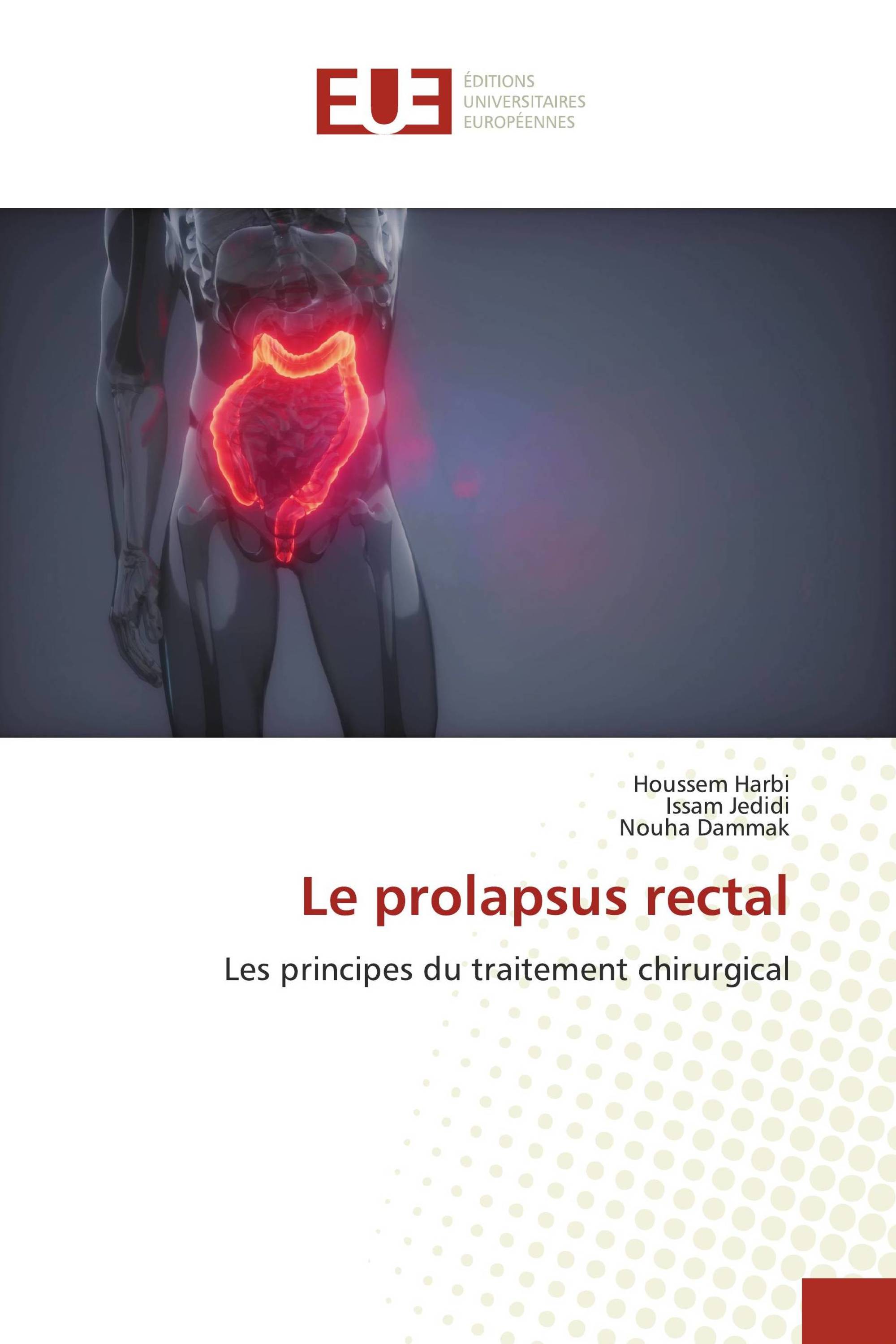 Le prolapsus rectal