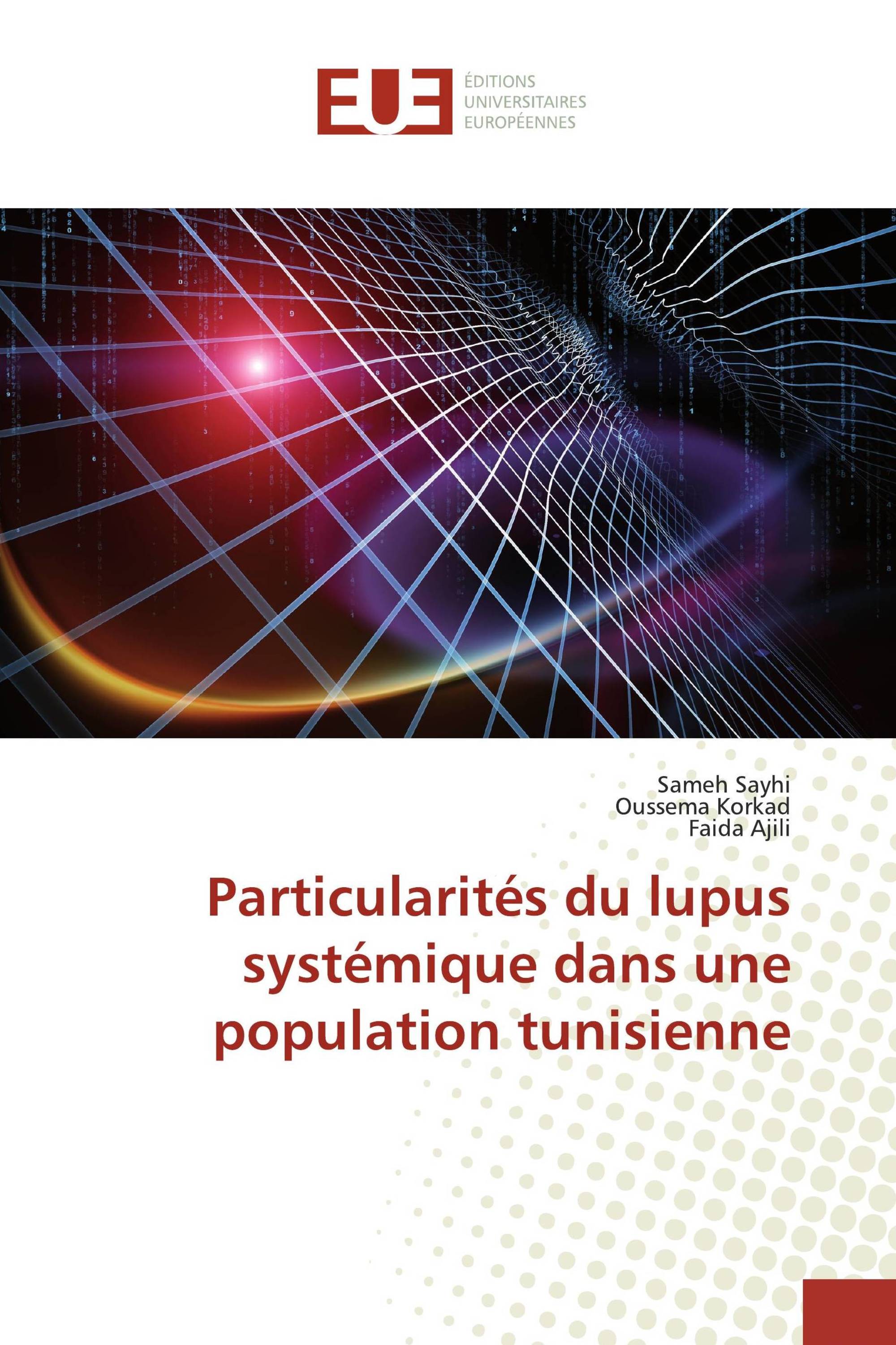 Particularités du lupus systémique dans une population tunisienne