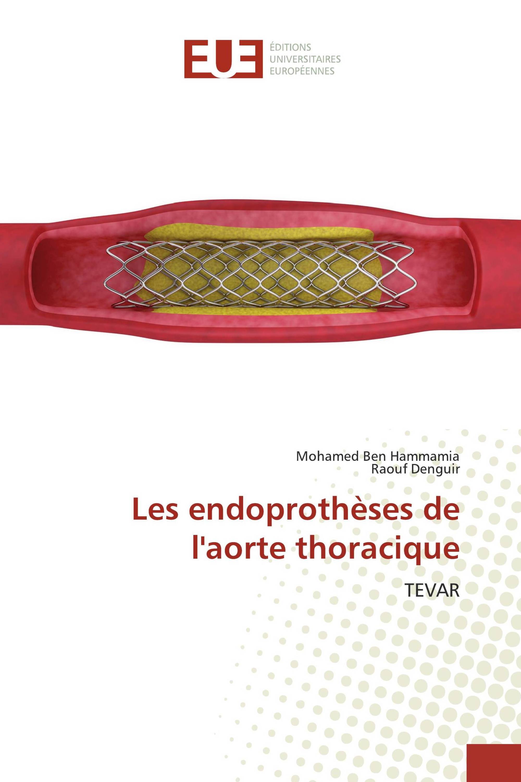 Les endoprothèses de l'aorte thoracique