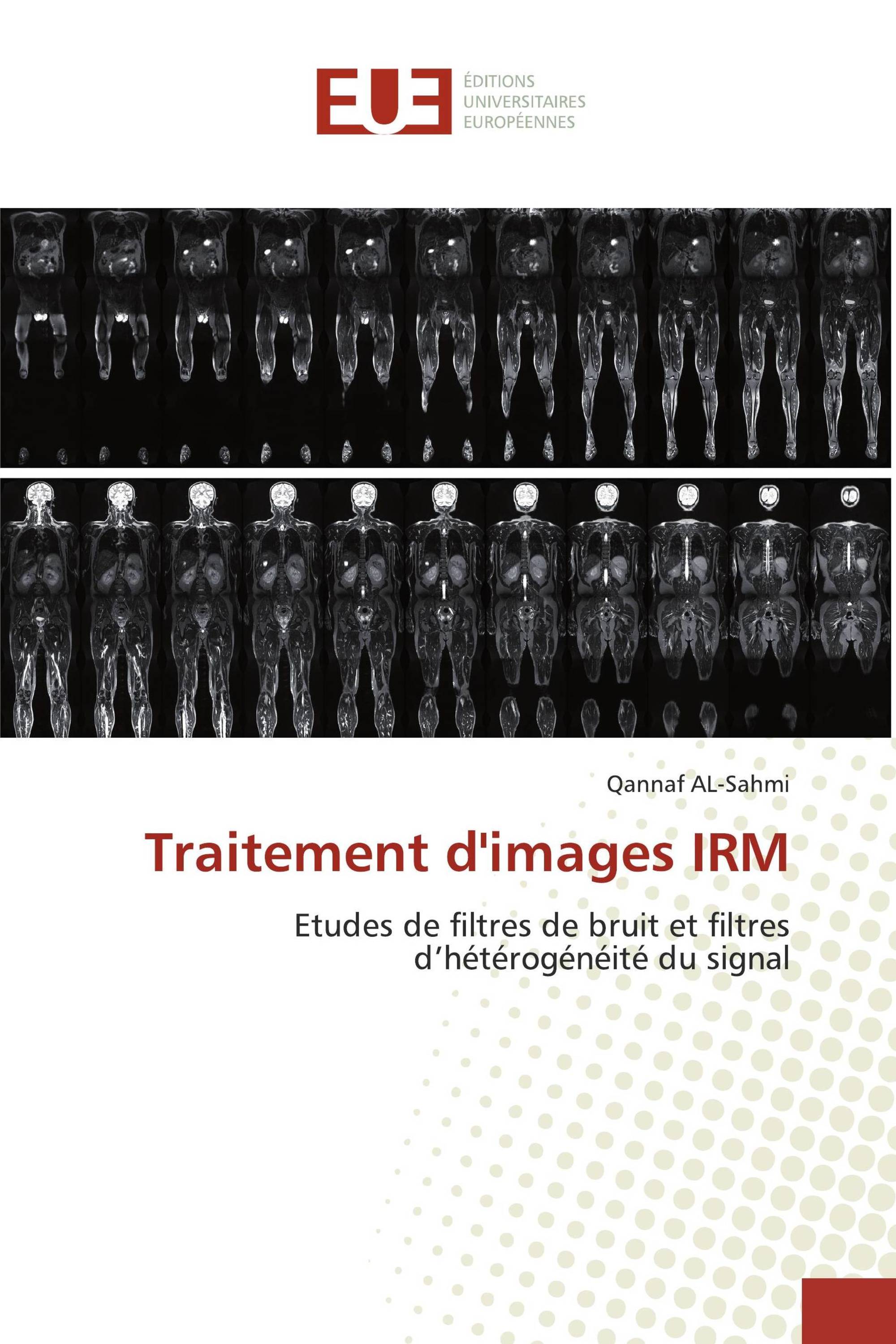 Traitement d'images IRM