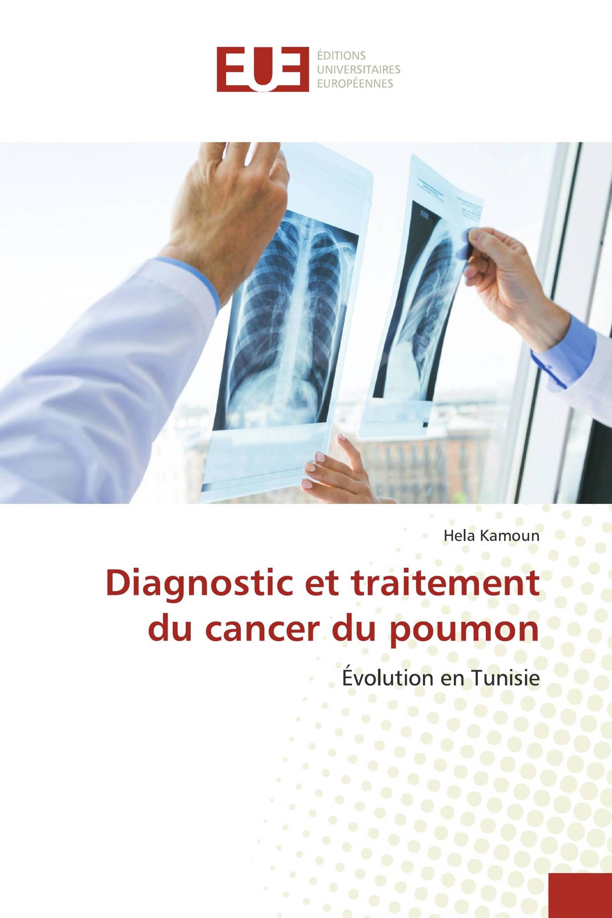 Diagnostic et traitement du cancer du poumon