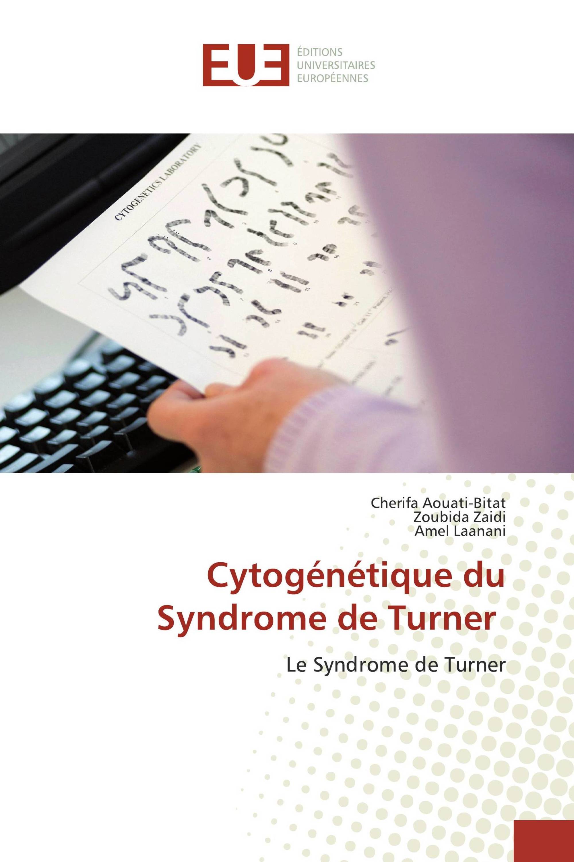 Cytogénétique du Syndrome de Turner