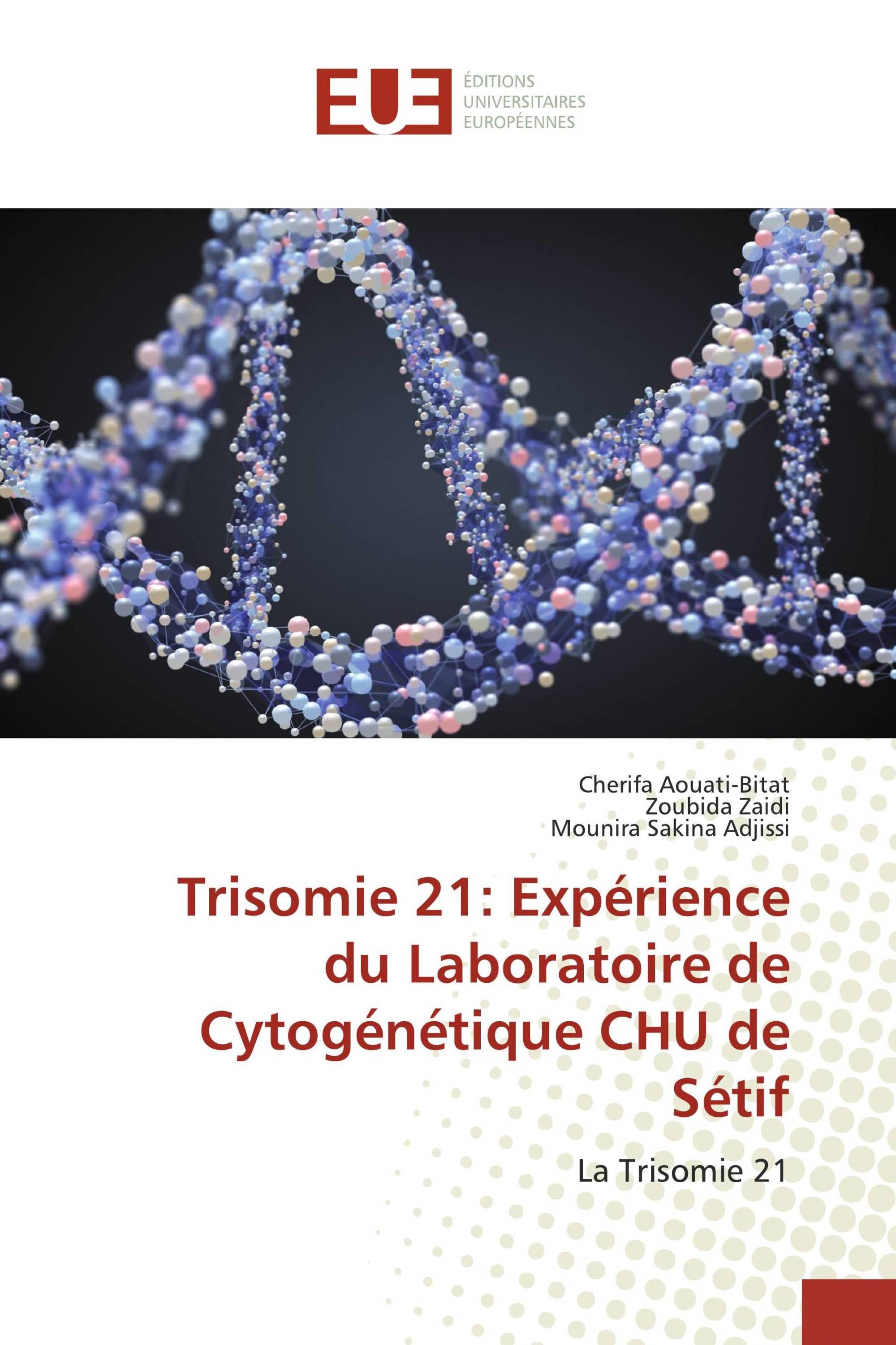 Trisomie 21: Expérience du Laboratoire de Cytogénétique CHU de Sétif