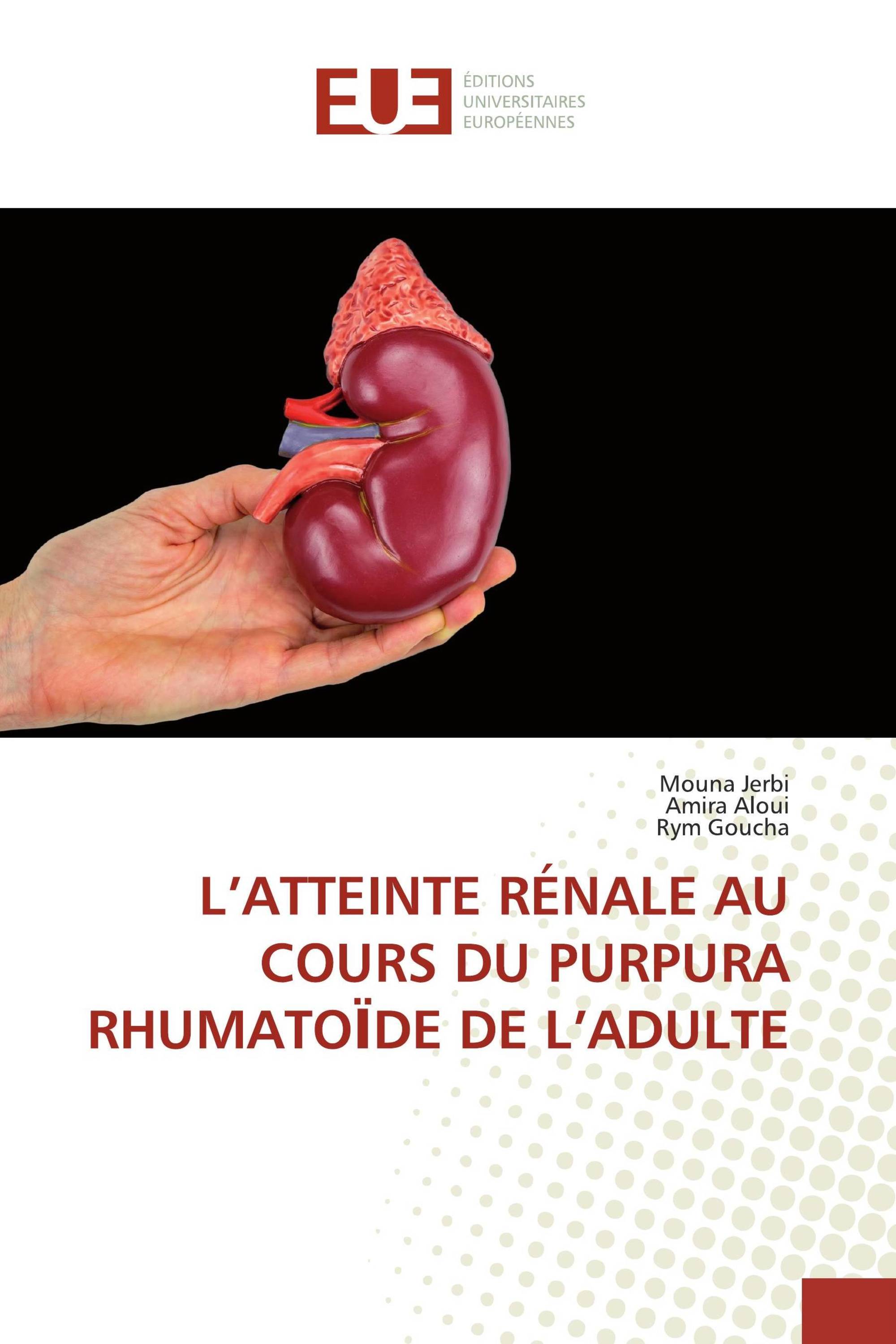 L’ATTEINTE RÉNALE AU COURS DU PURPURA RHUMATOЇDE DE L’ADULTE