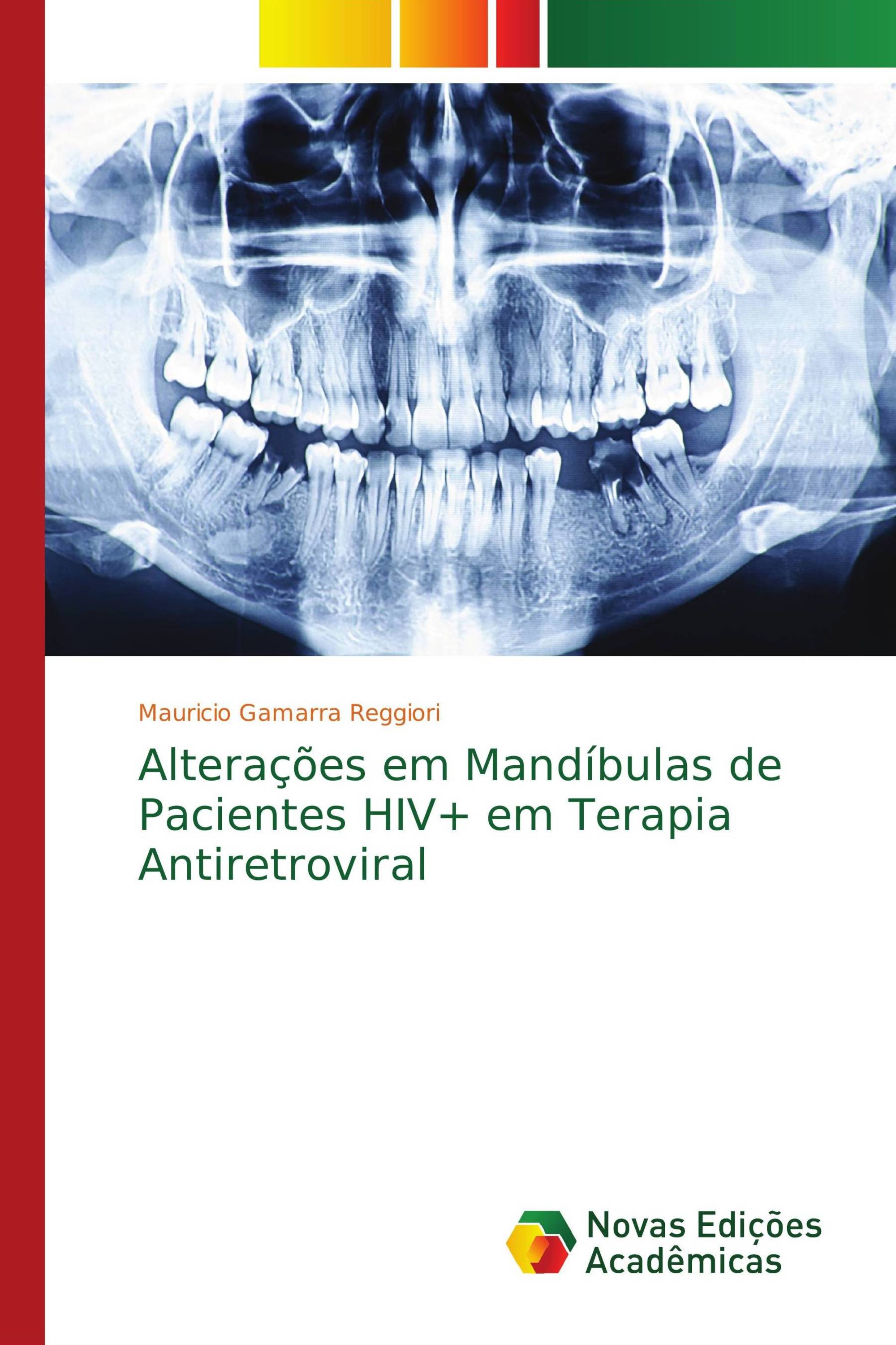 Alterações em Mandíbulas de Pacientes HIV+ em Terapia Antiretroviral