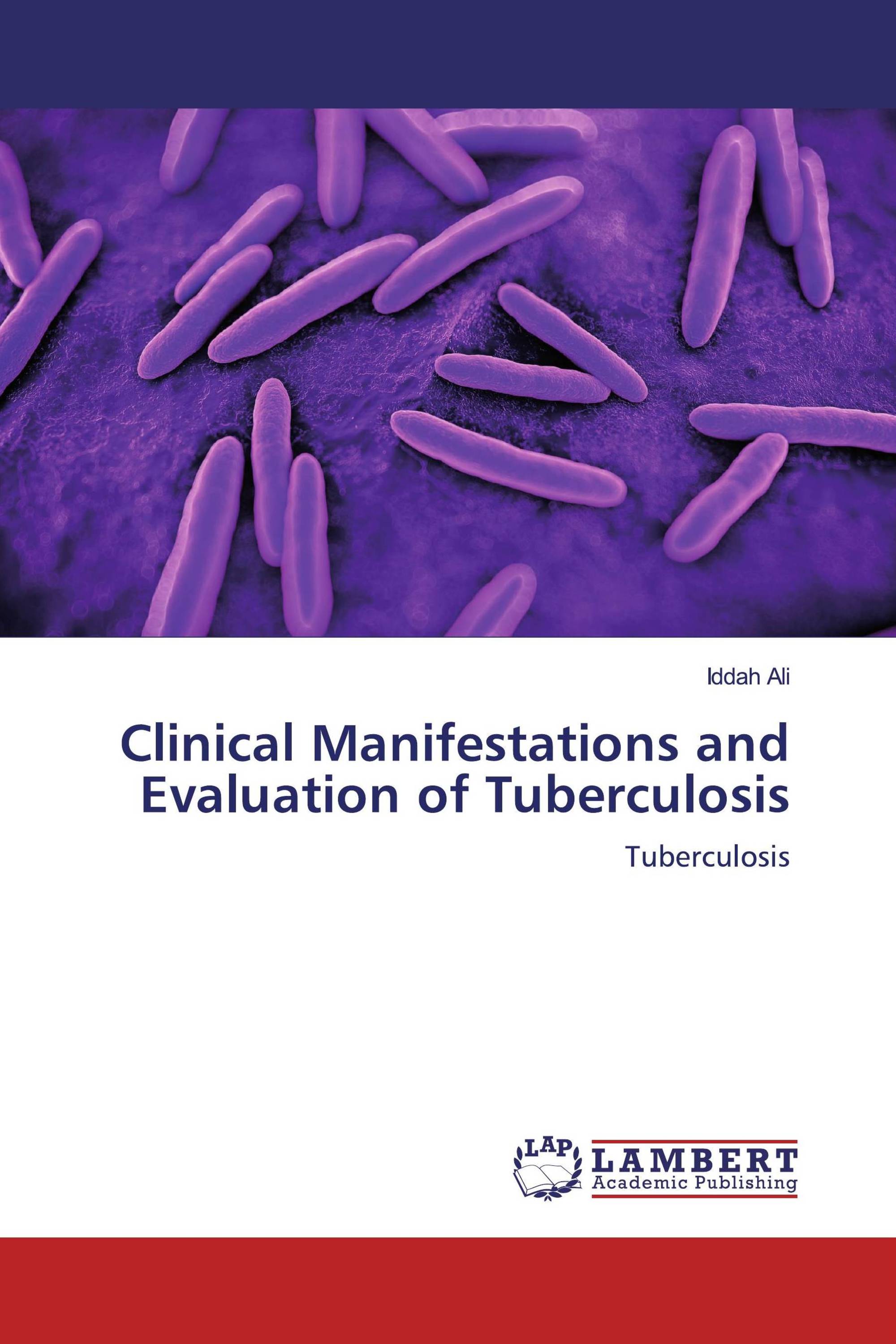 Clinical Manifestations and Evaluation of Tuberculosis