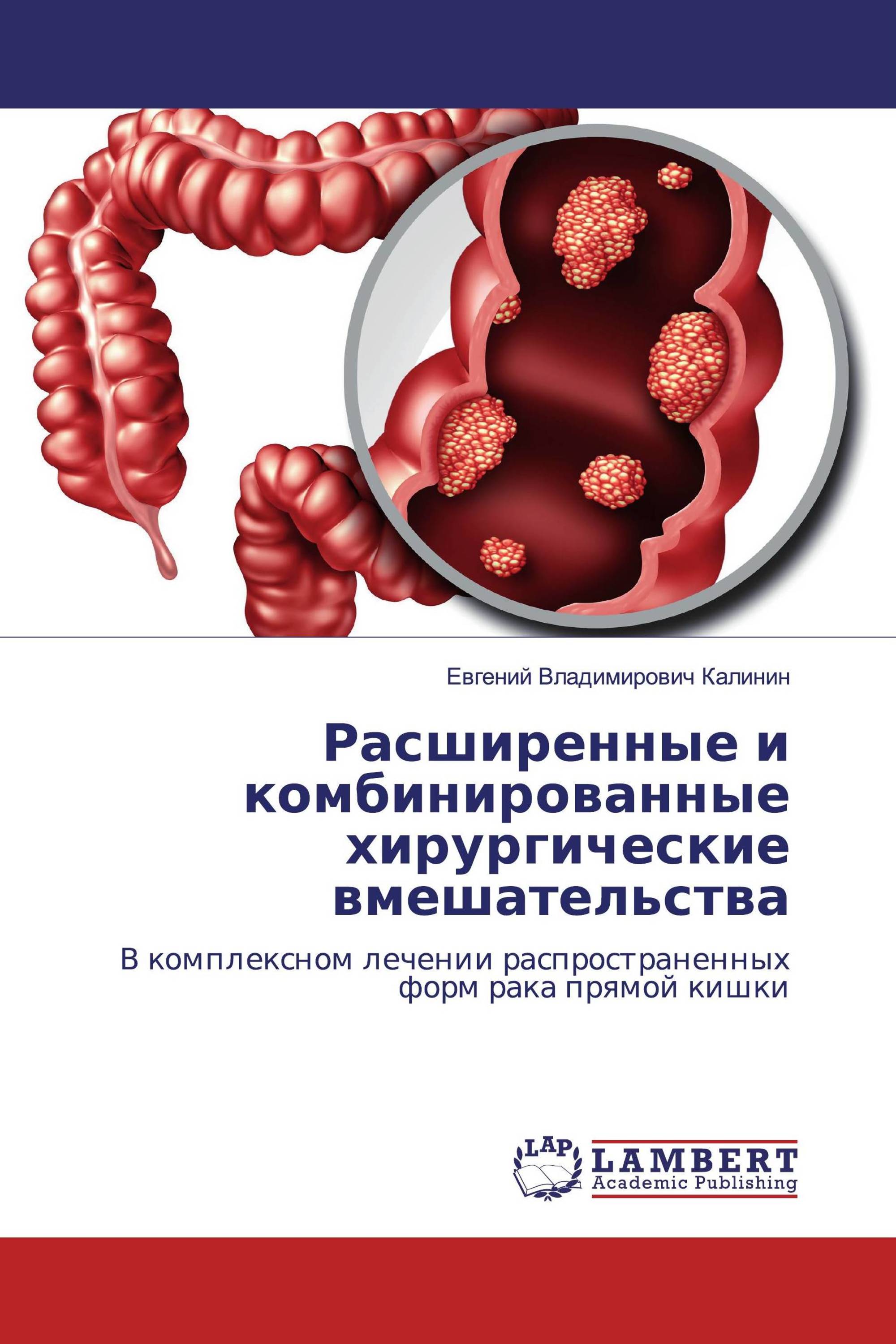 Расширенные и комбинированные хирургические вмешательства