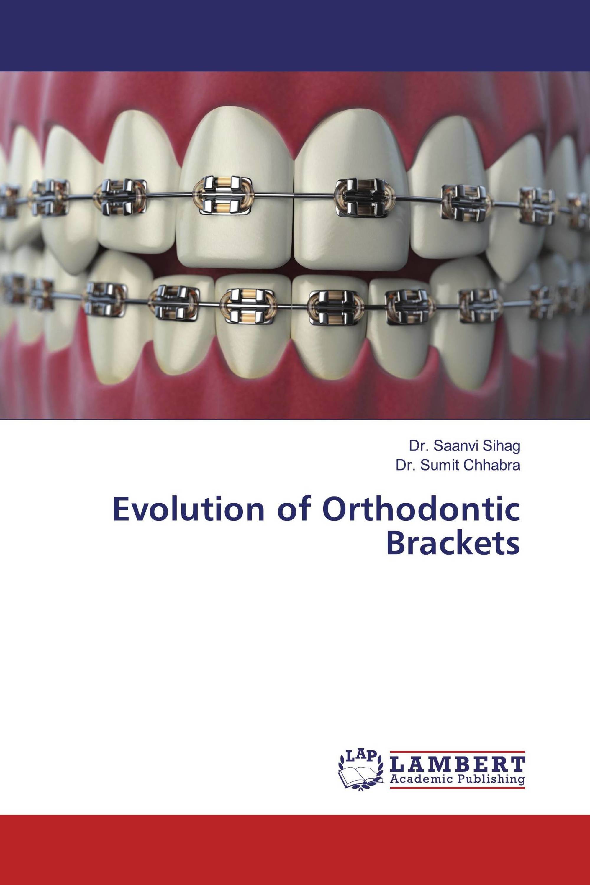 Evolution Of Orthodontic Brackets / 978-613-9-91798-3 / 9786139917983 ...