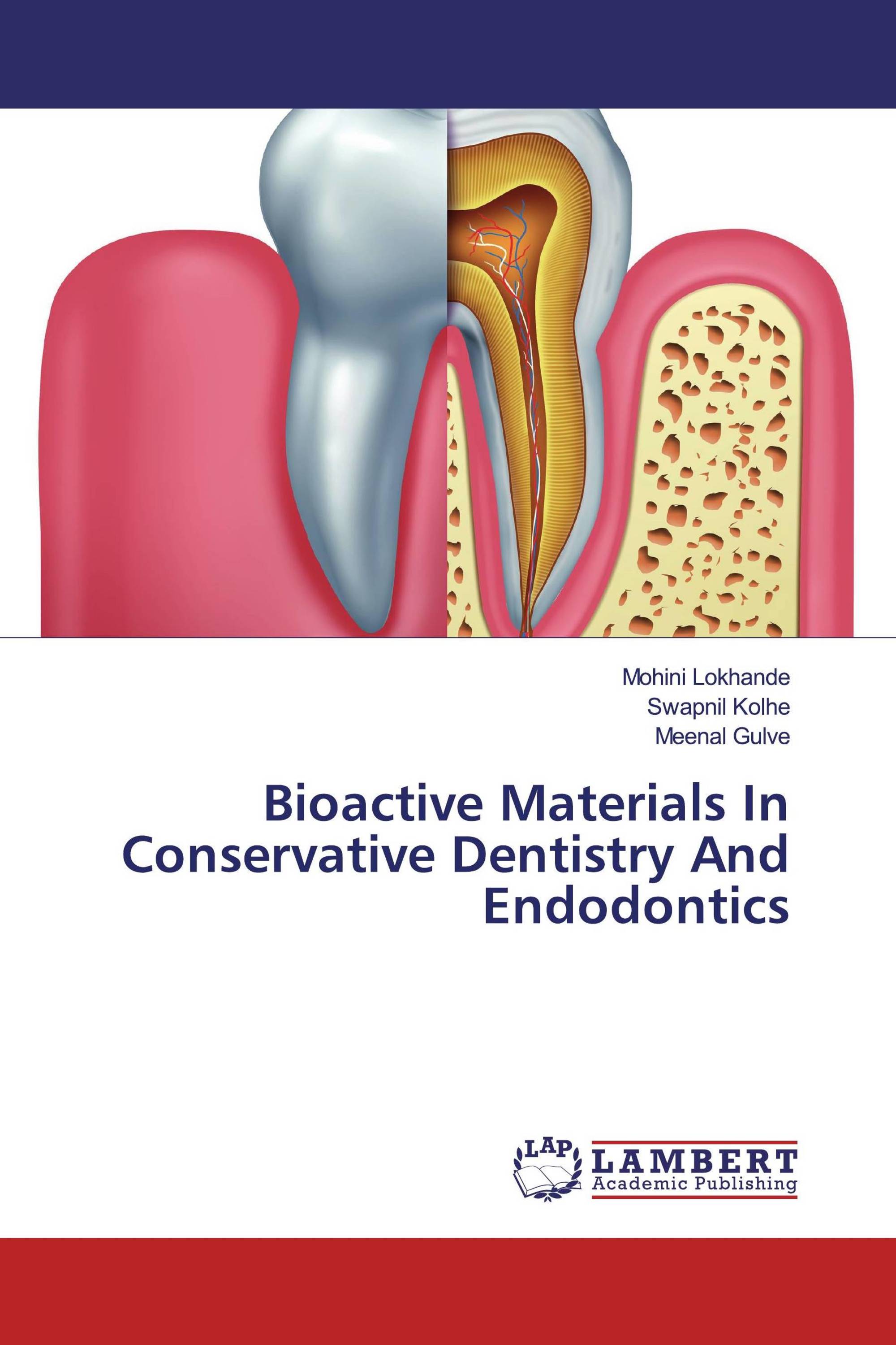 Bioactive Materials In Conservative Dentistry And Endodontics