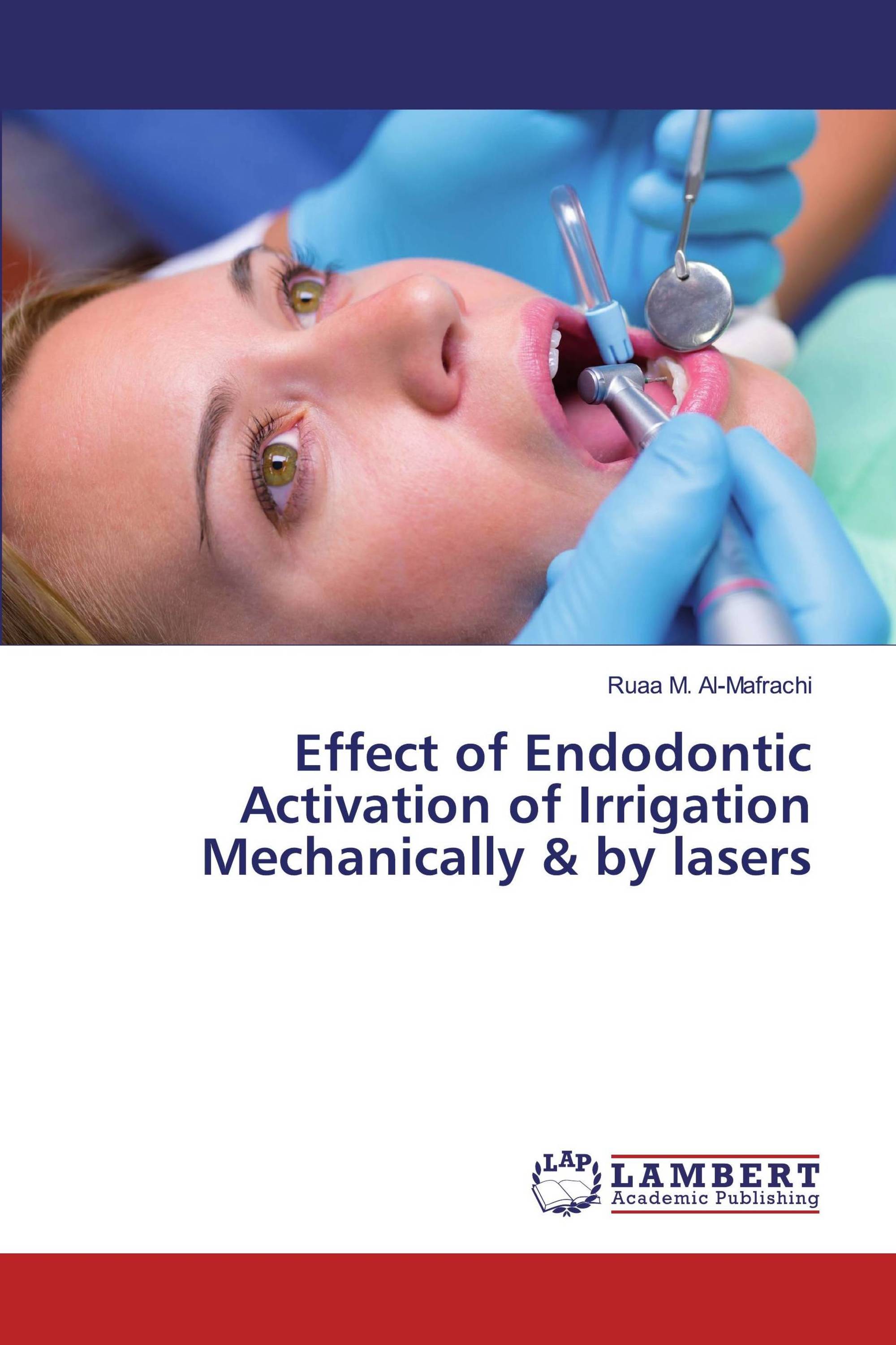 Effect of Endodontic Activation of Irrigation Mechanically & by lasers
