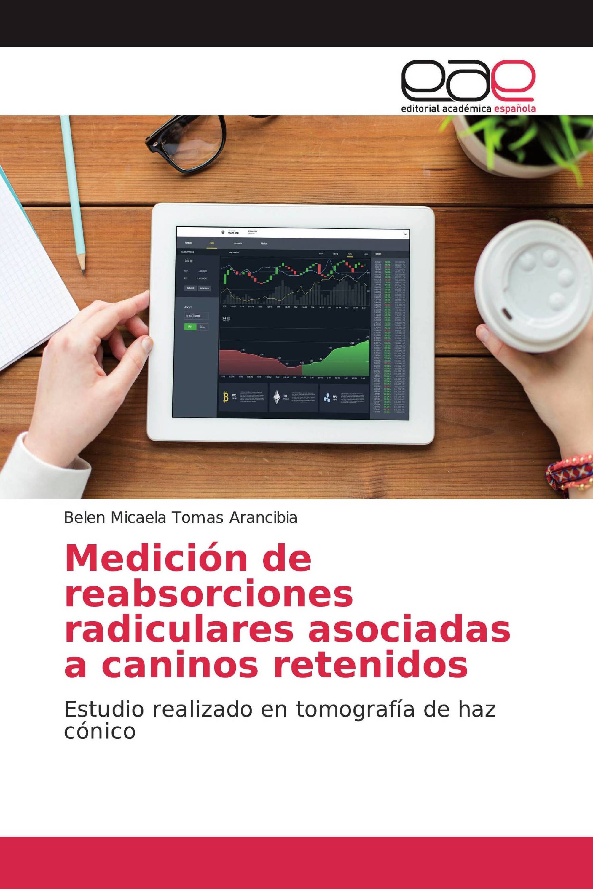 Medición de reabsorciones radiculares asociadas a caninos retenidos