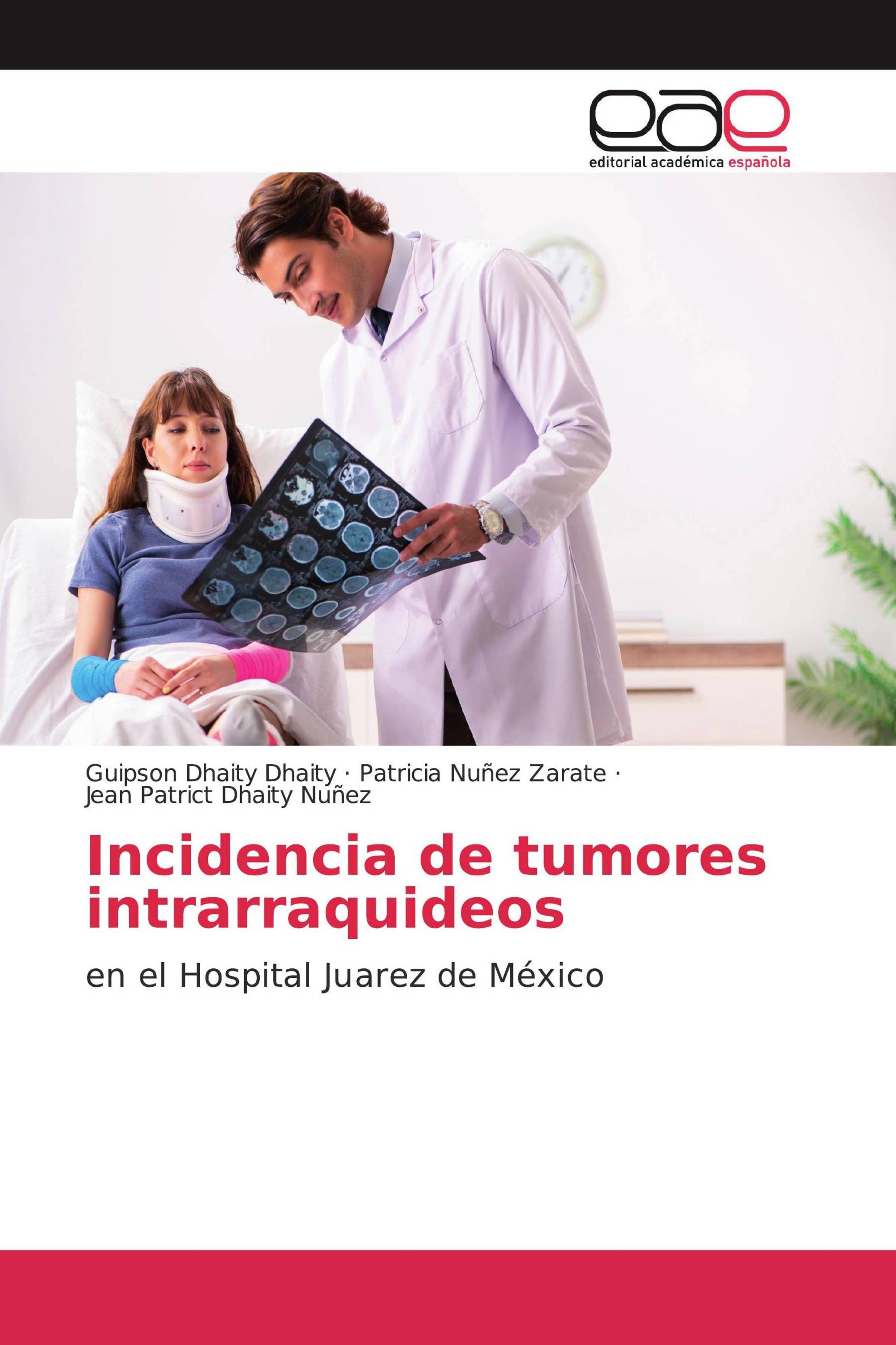 Incidencia de tumores intrarraquideos