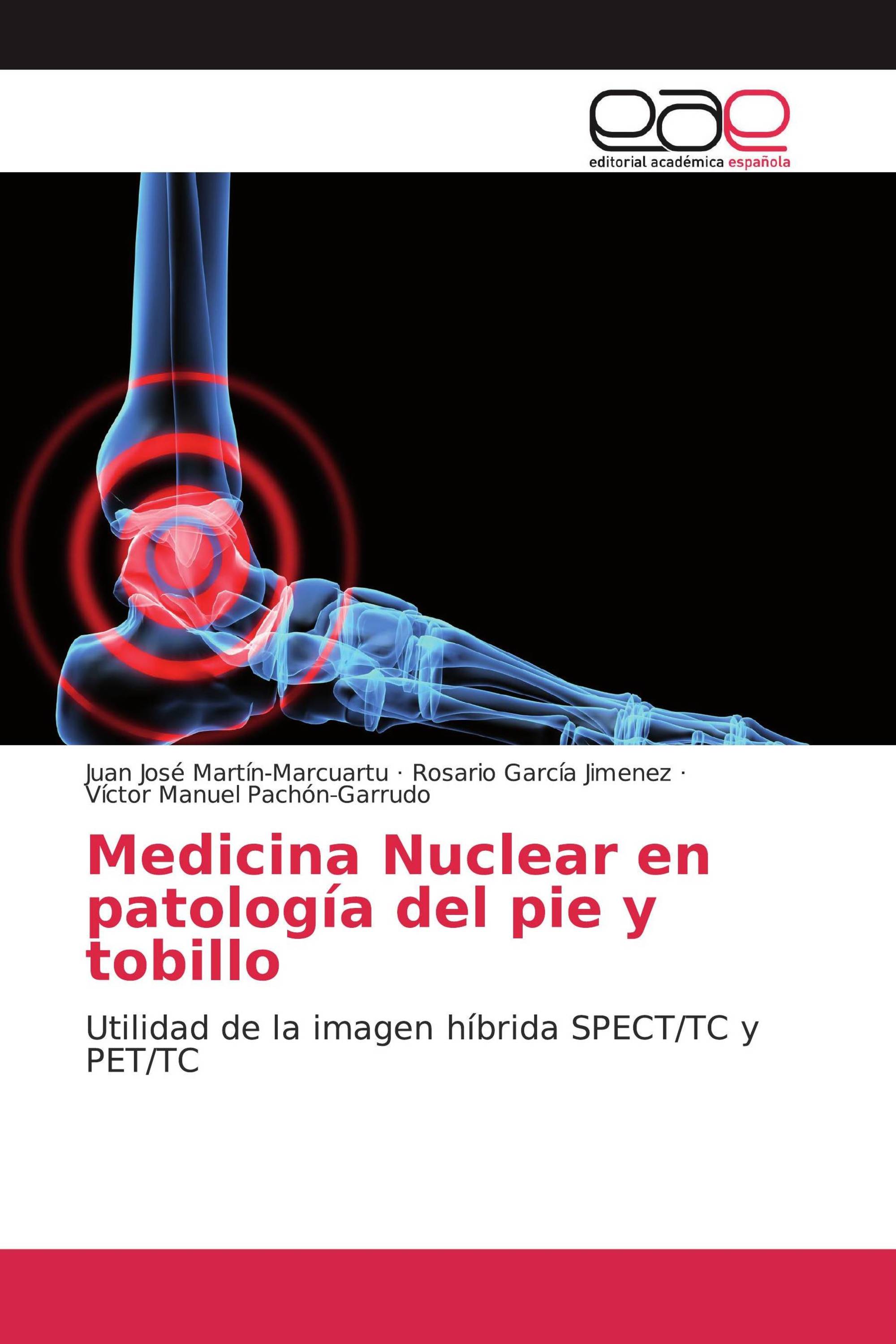 Medicina Nuclear en patología del pie y tobillo