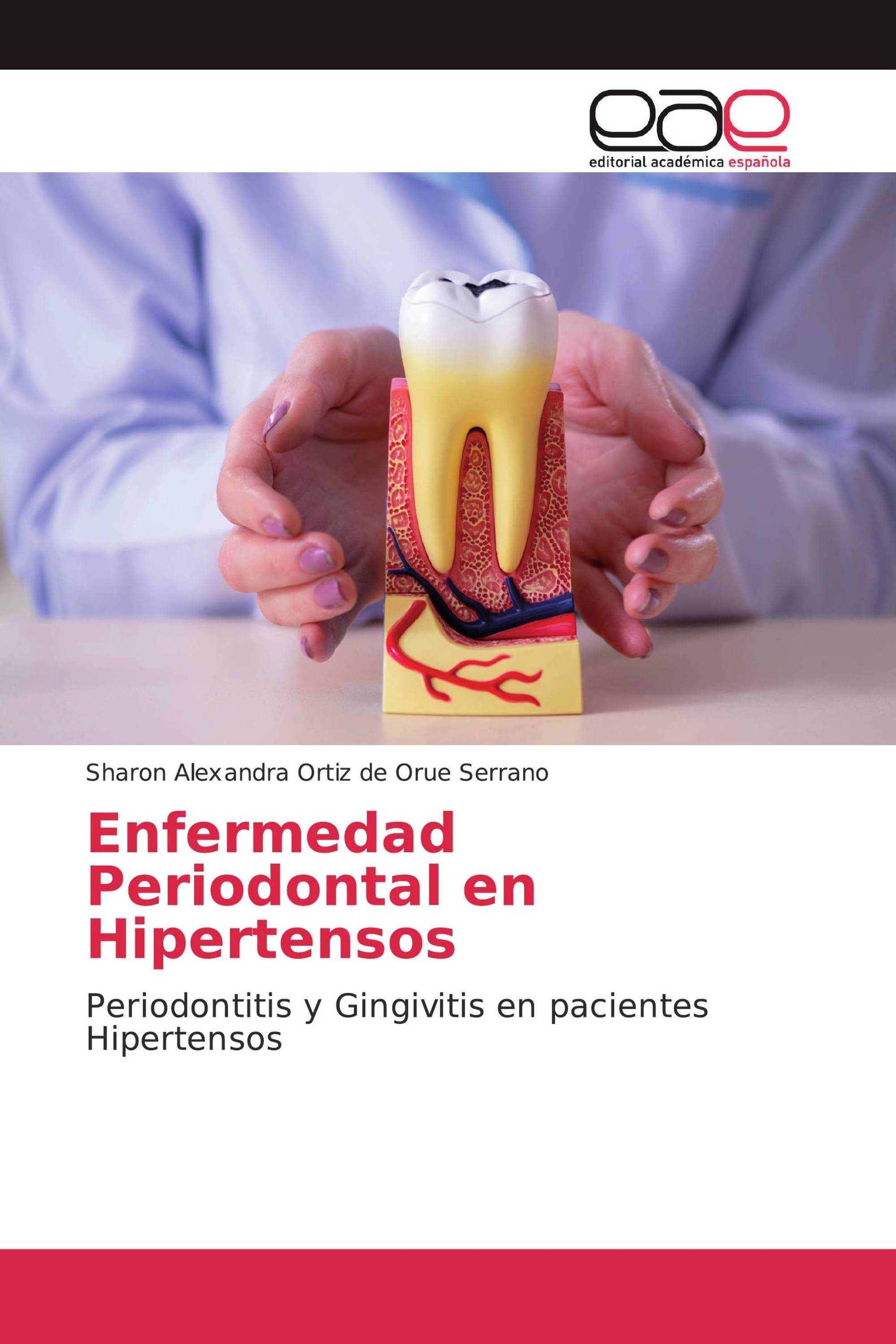 Enfermedad Periodontal en Hipertensos