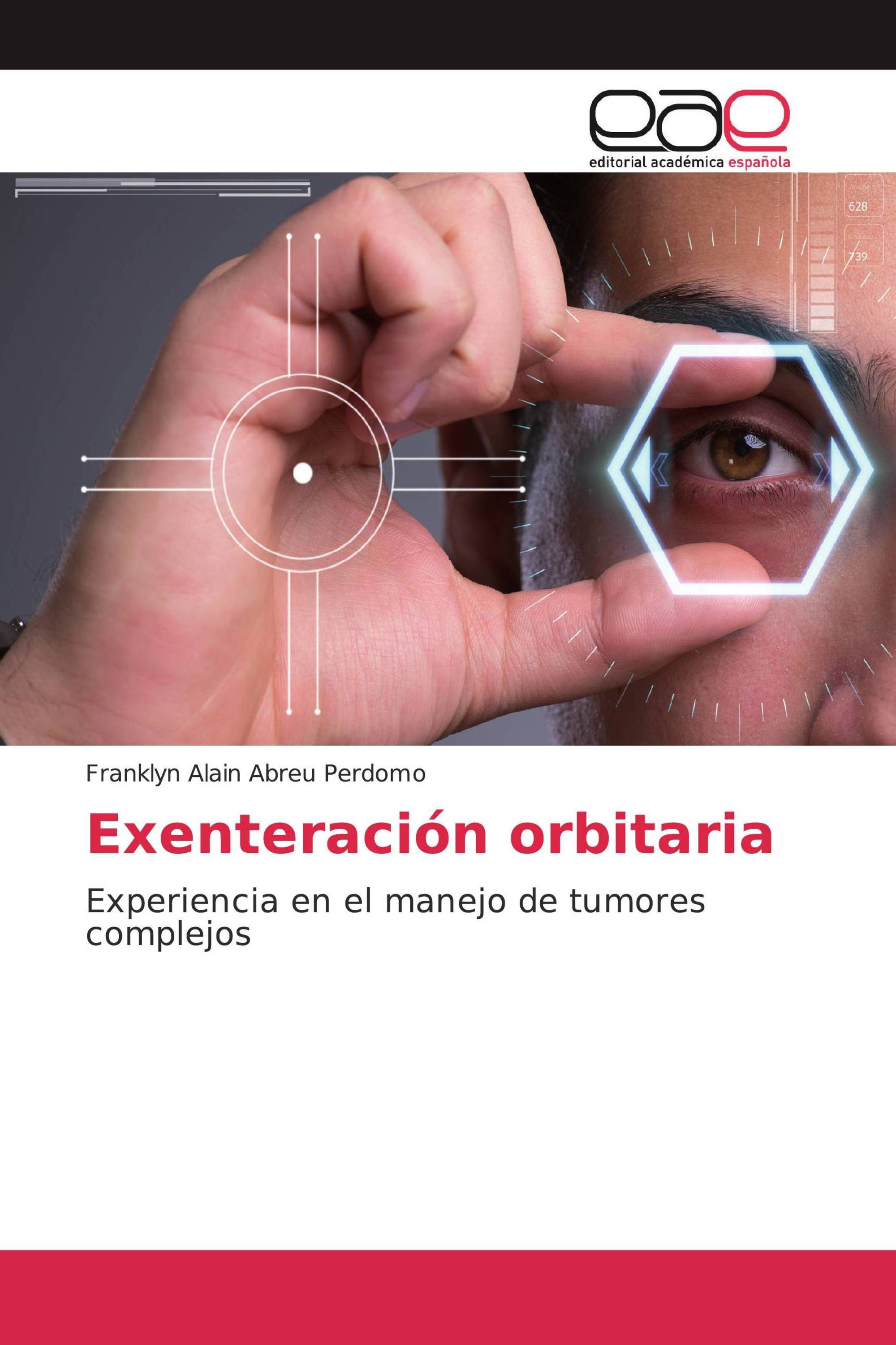 Exenteración orbitaria