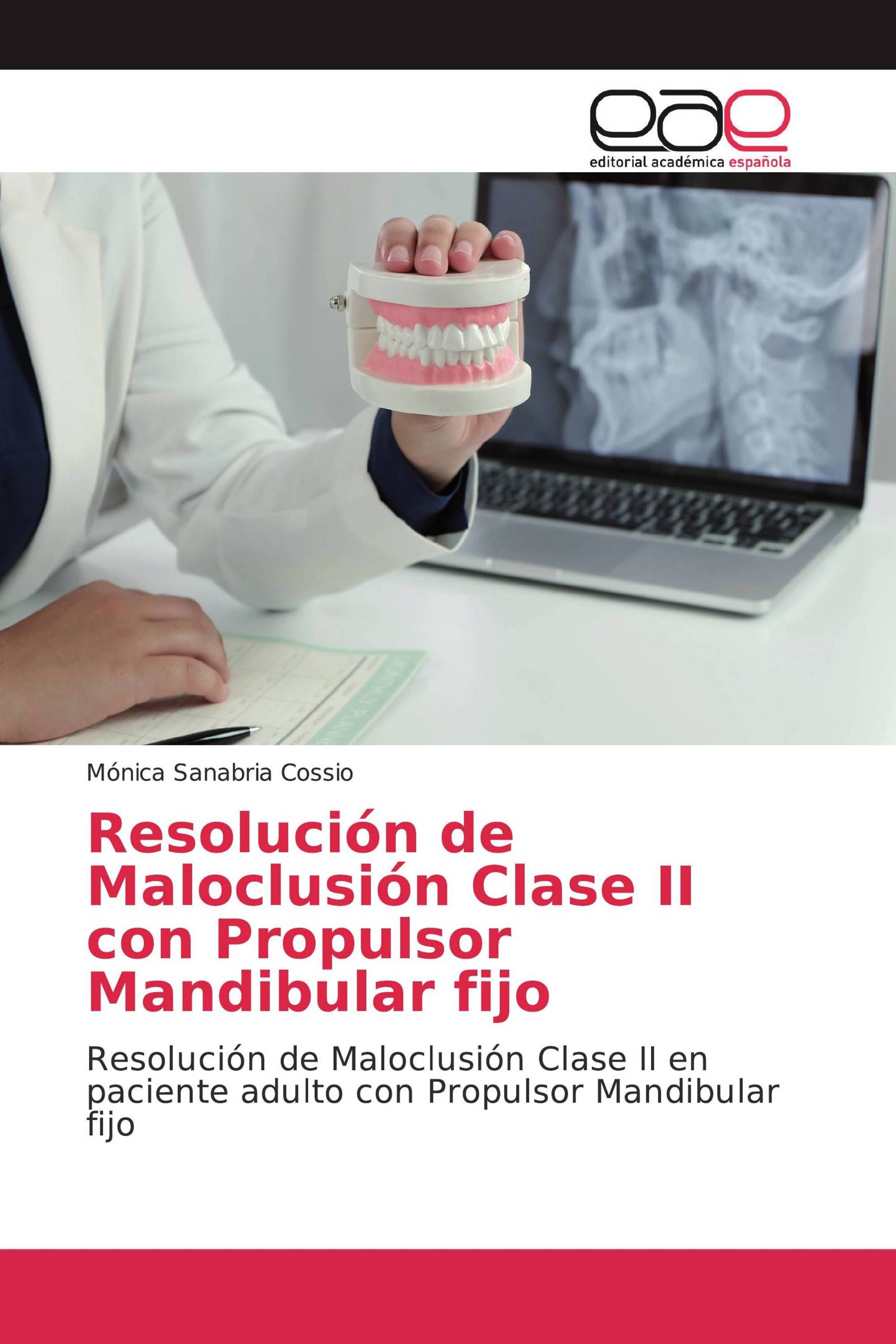 Resolución de Maloclusión Clase II con Propulsor Mandibular fijo