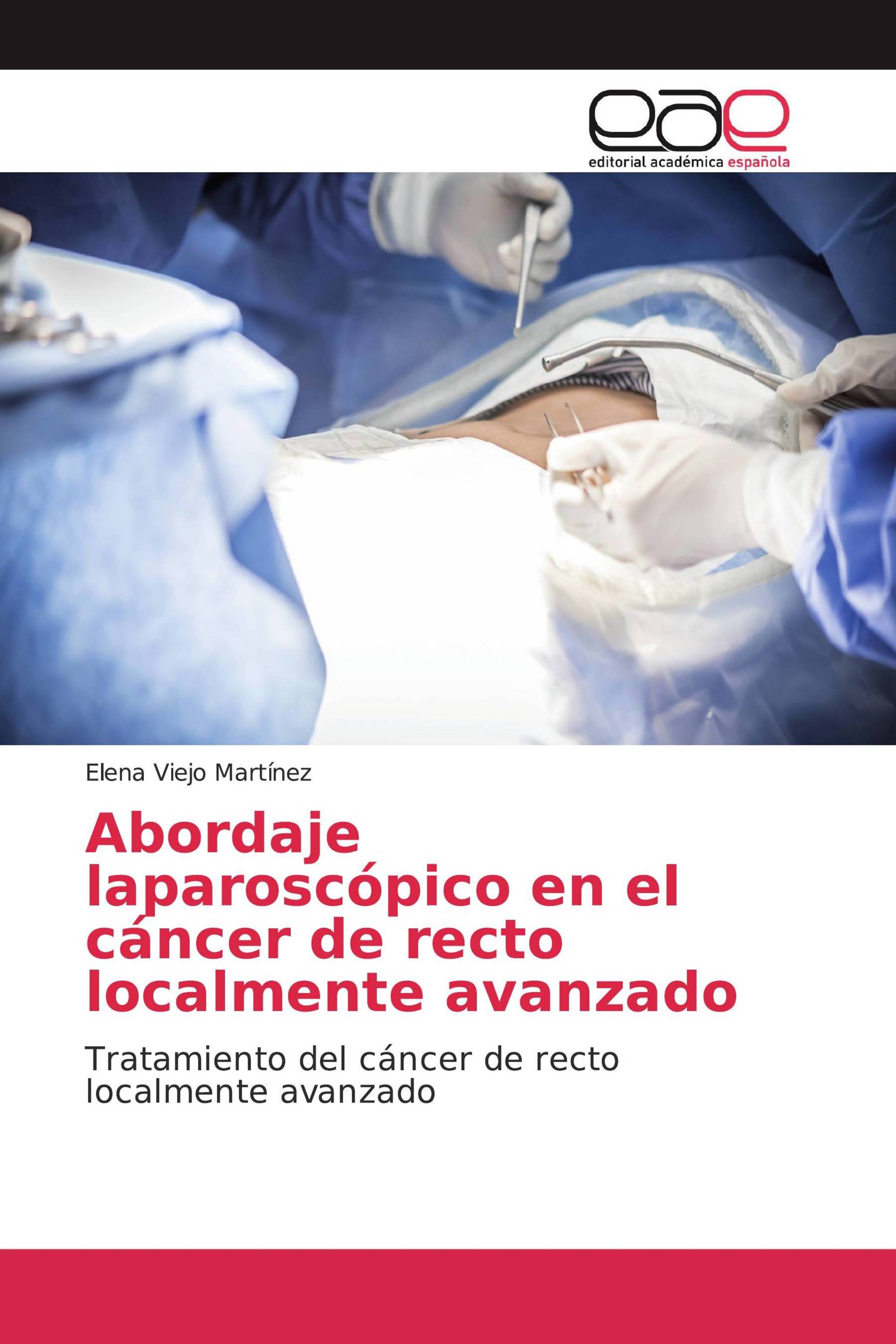 Abordaje laparoscópico en el cáncer de recto localmente avanzado