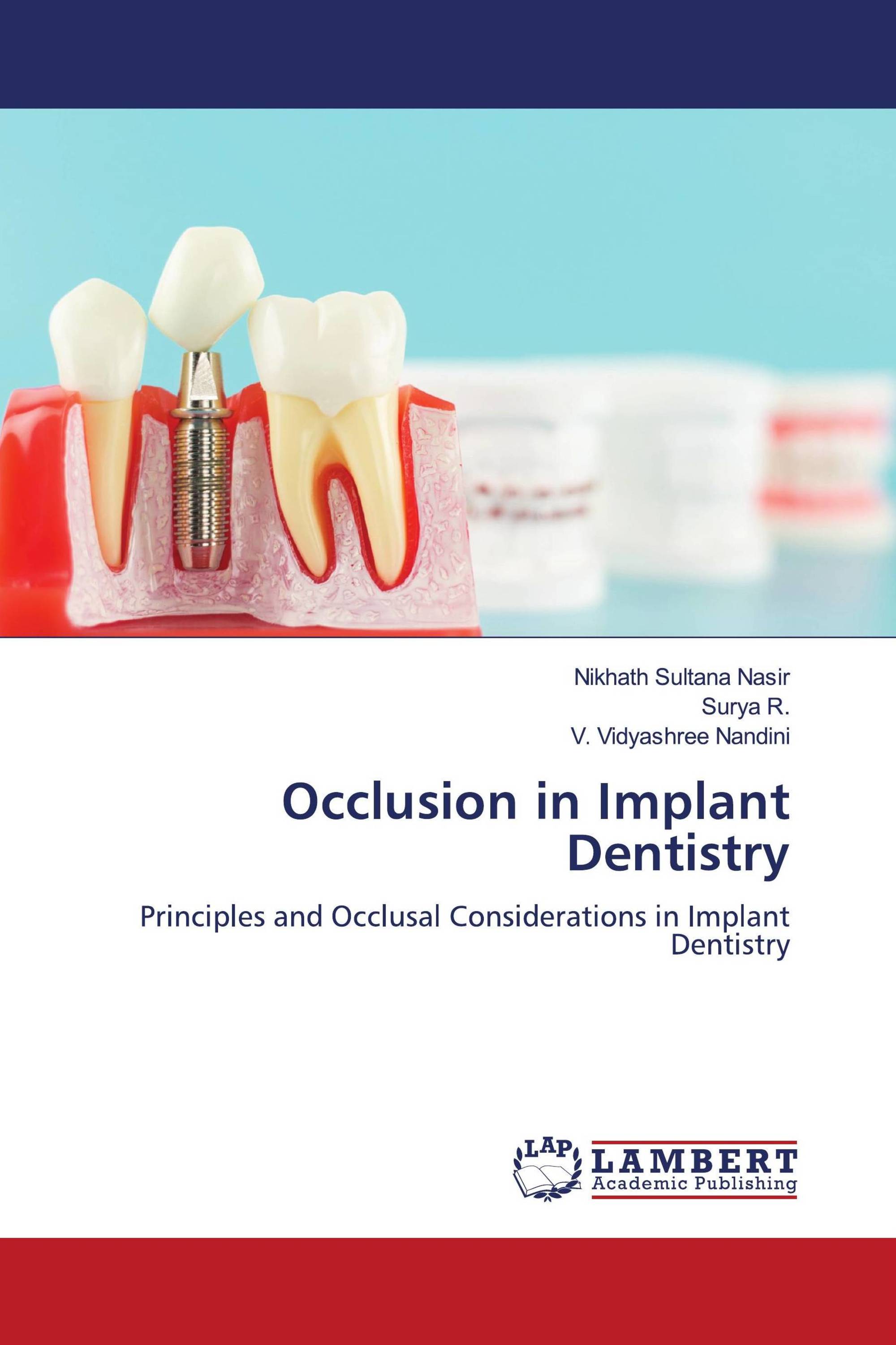 Occlusion in Implant Dentistry / 9786200091161 / 9786200091161