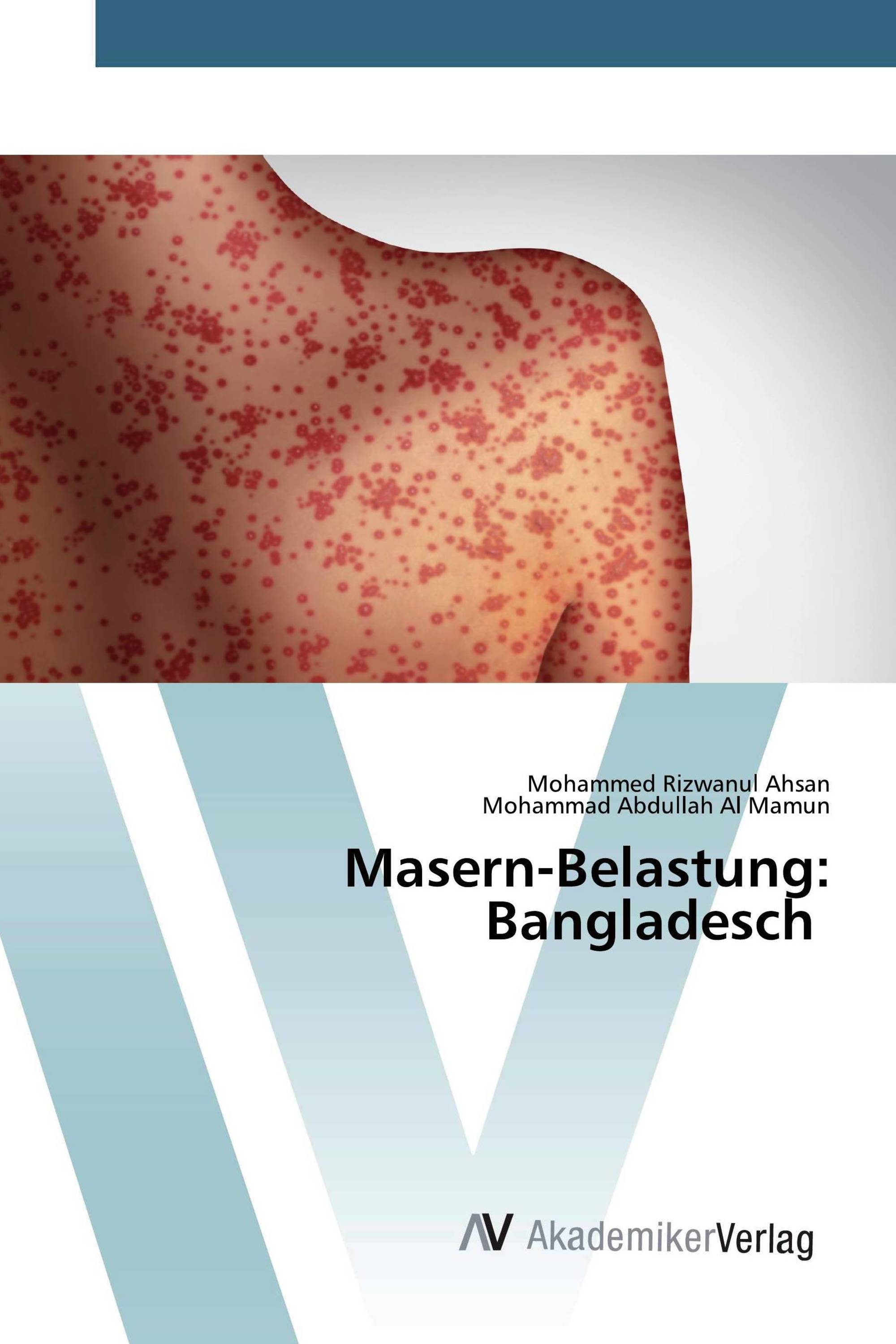 Masern-Belastung: Bangladesch