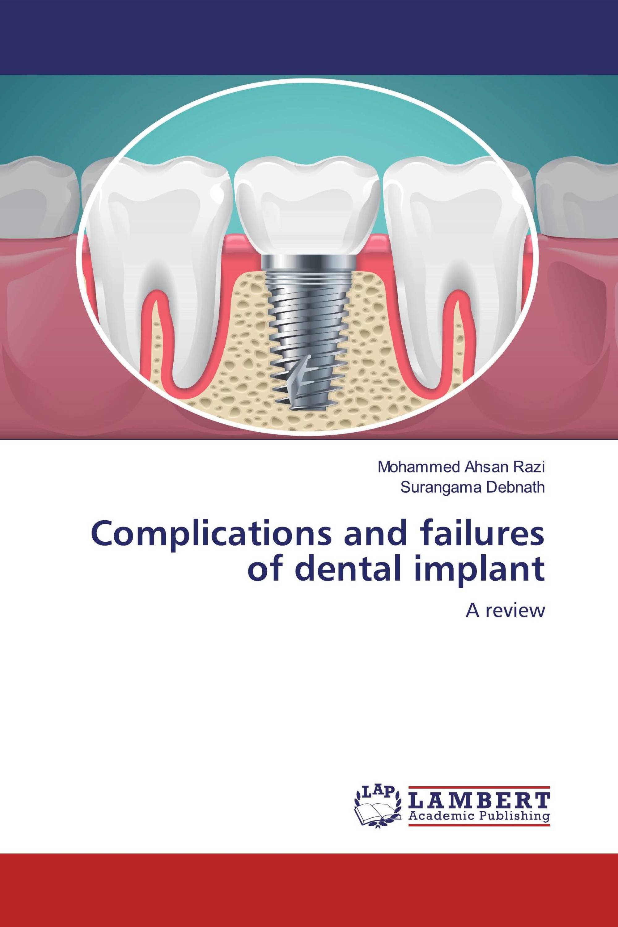 Complications and failures of dental implant