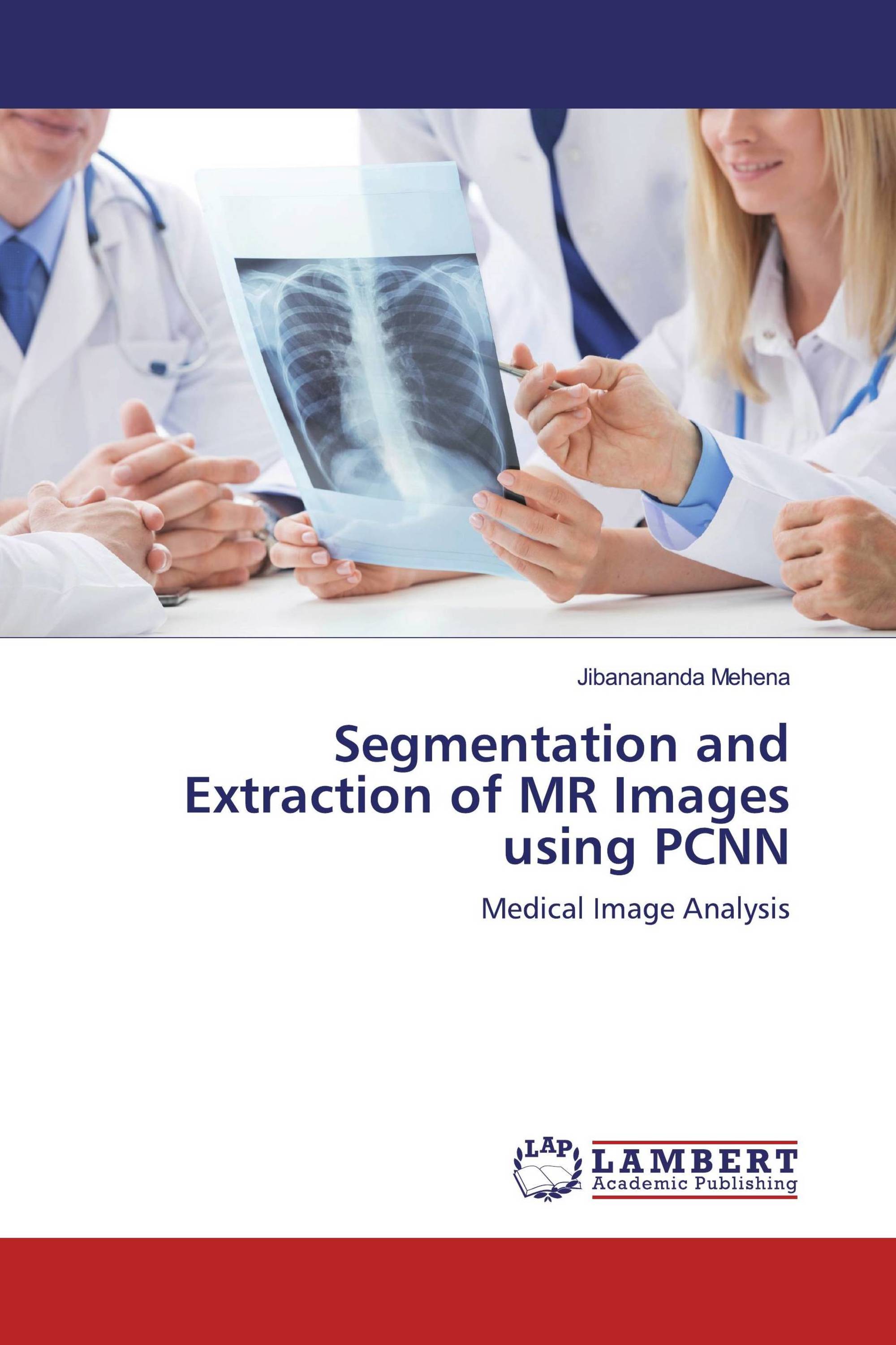 Segmentation and Extraction of MR Images using PCNN