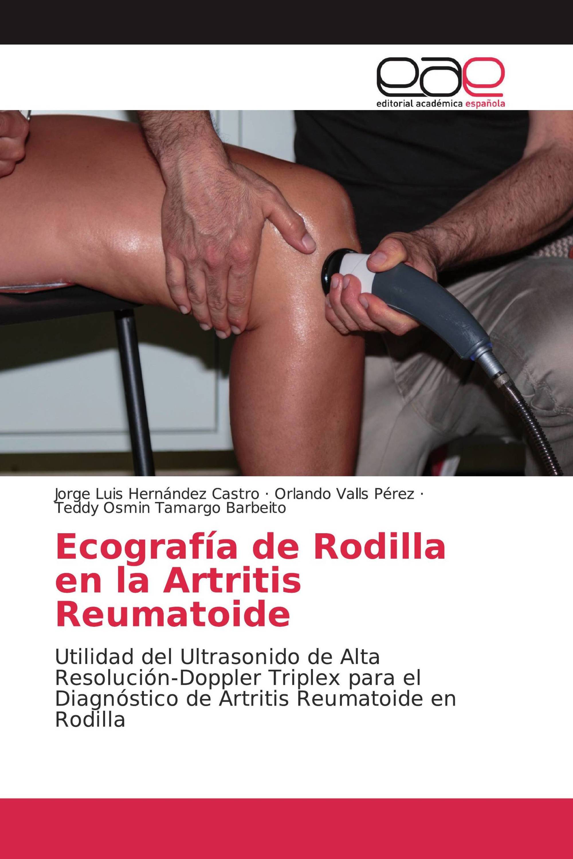 Ecografía de Rodilla en la Artritis Reumatoide