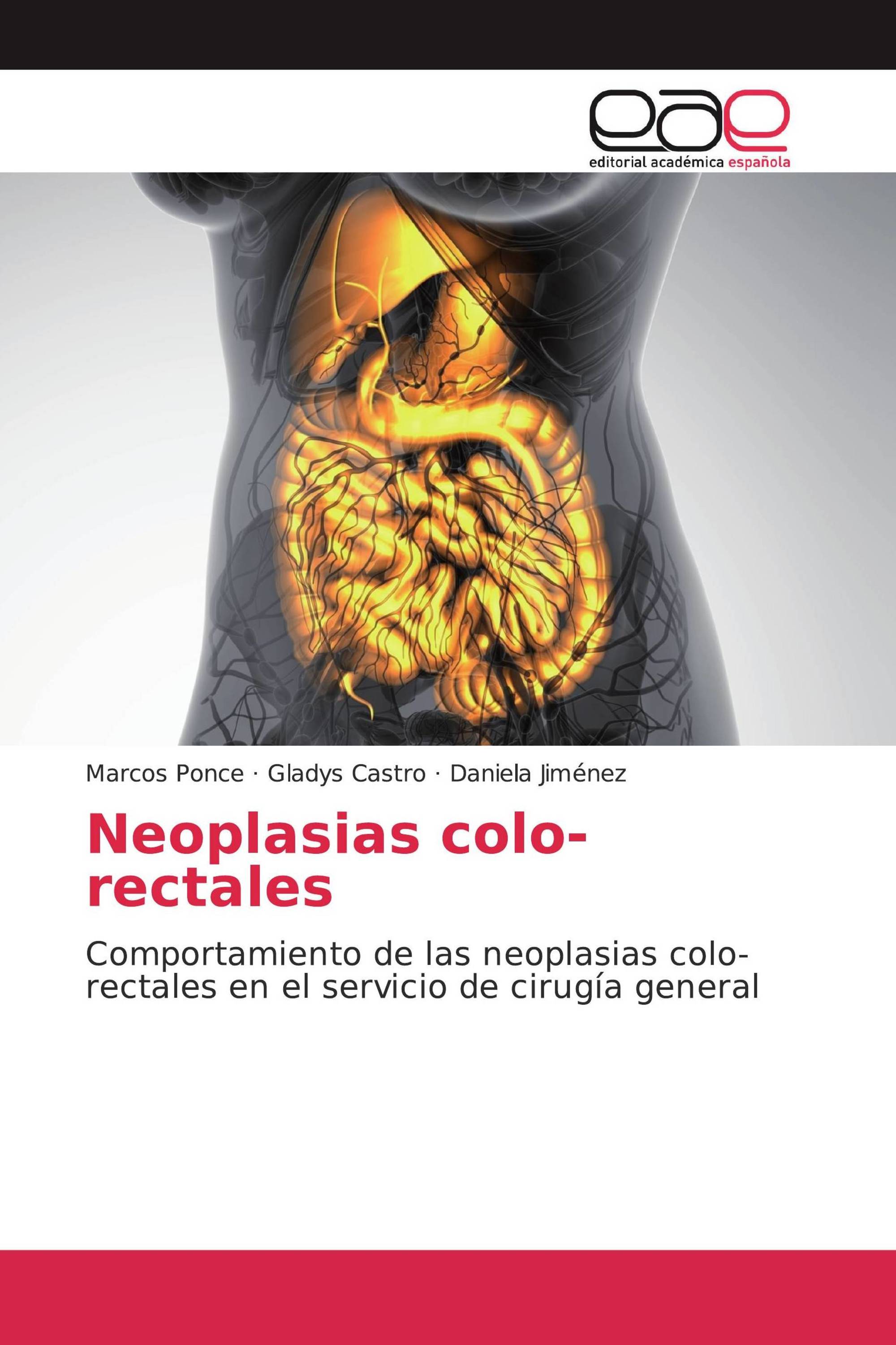 Neoplasias colo-rectales