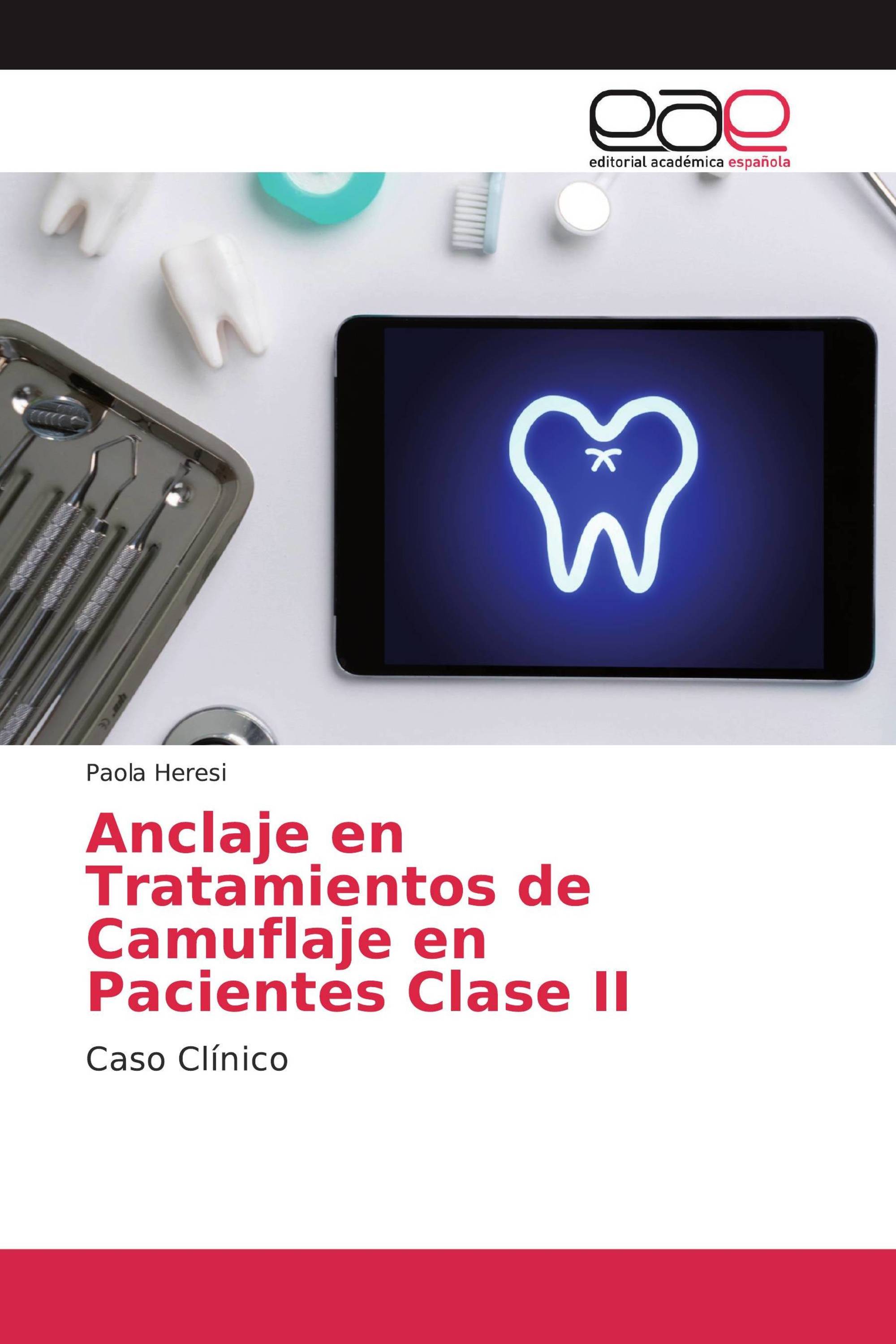 Anclaje en Tratamientos de Camuflaje en Pacientes Clase II