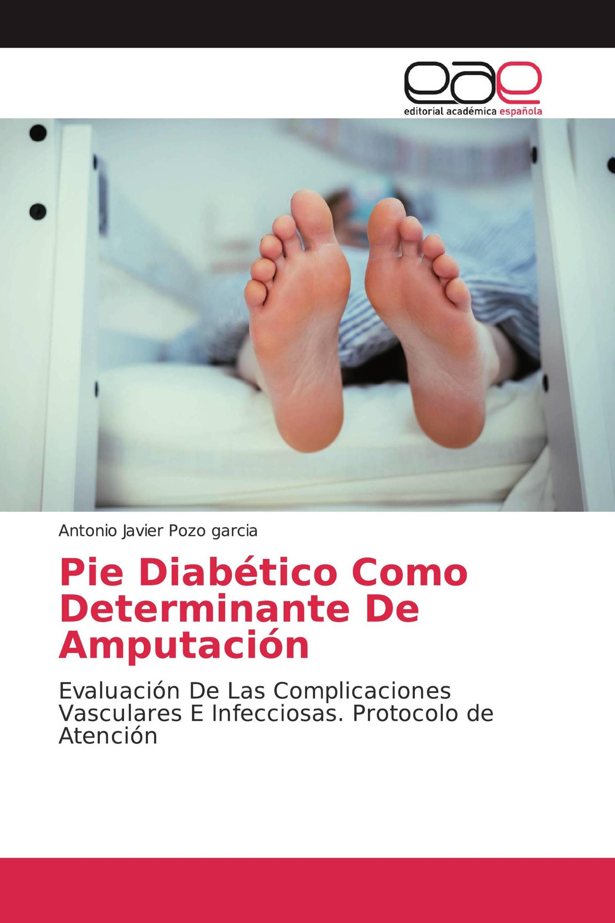 Pie Diabético Como Determinante De Amputación