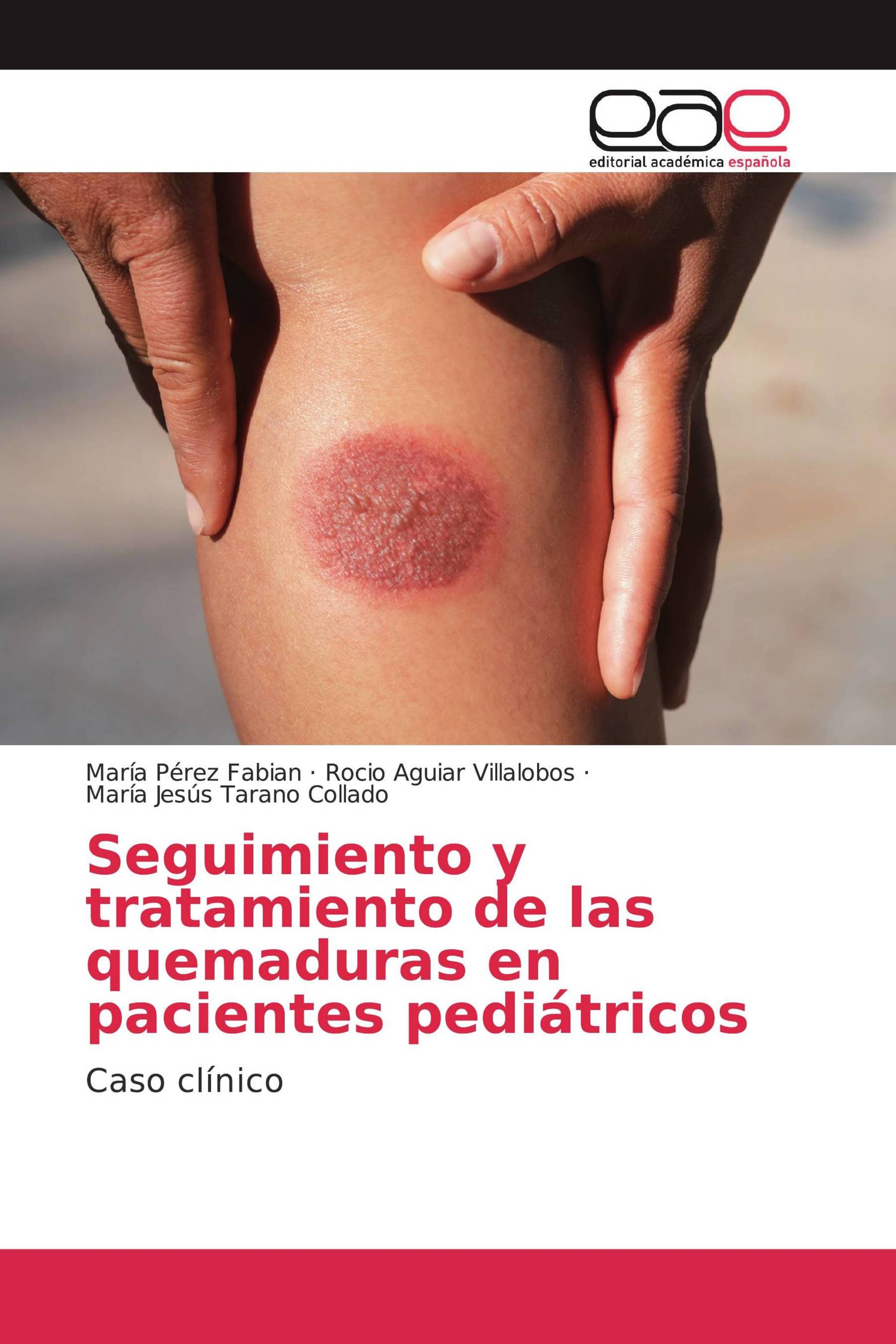 Seguimiento y tratamiento de las quemaduras en pacientes pediátricos