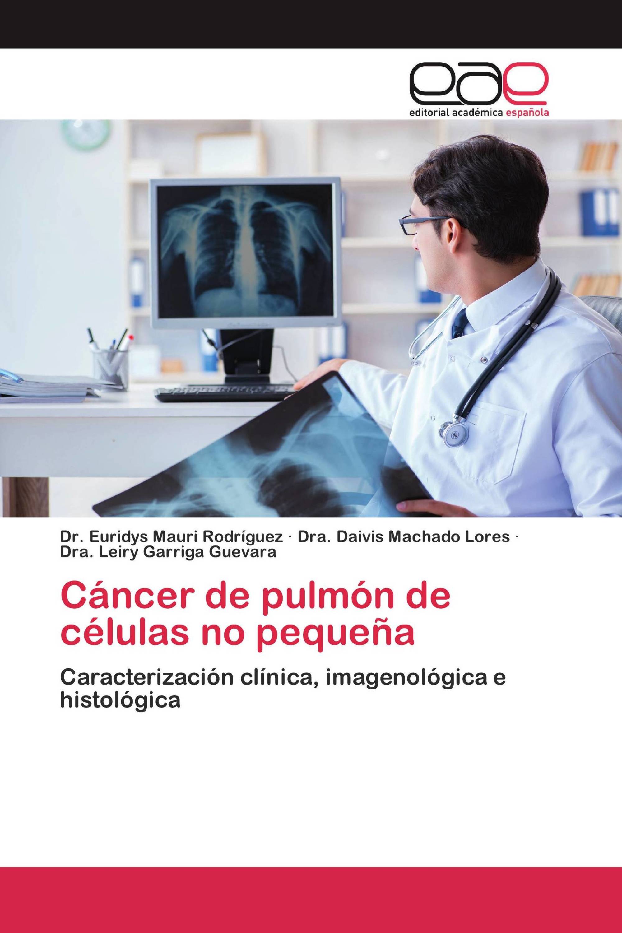 Cáncer de pulmón de células no pequeña