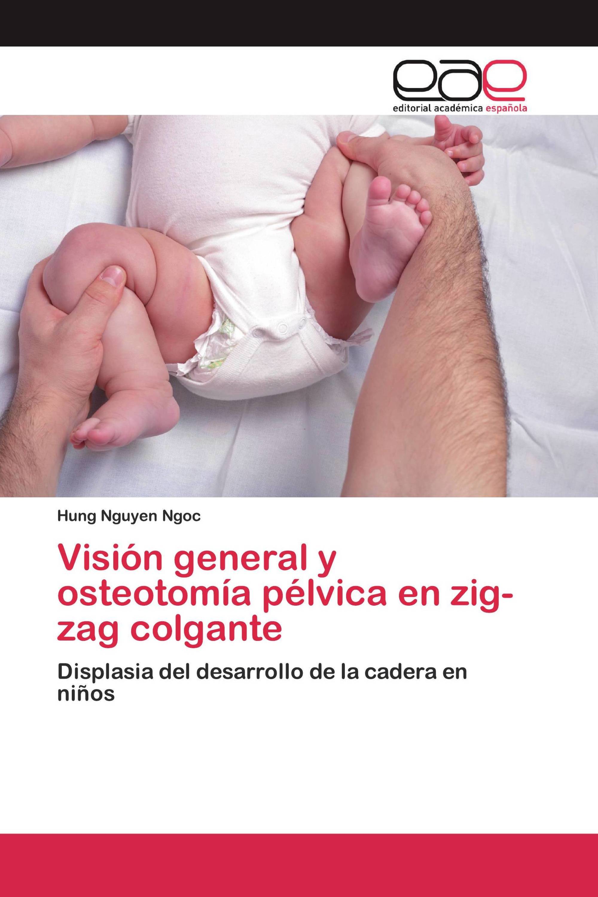 Visión general y osteotomía pélvica en zig-zag colgante