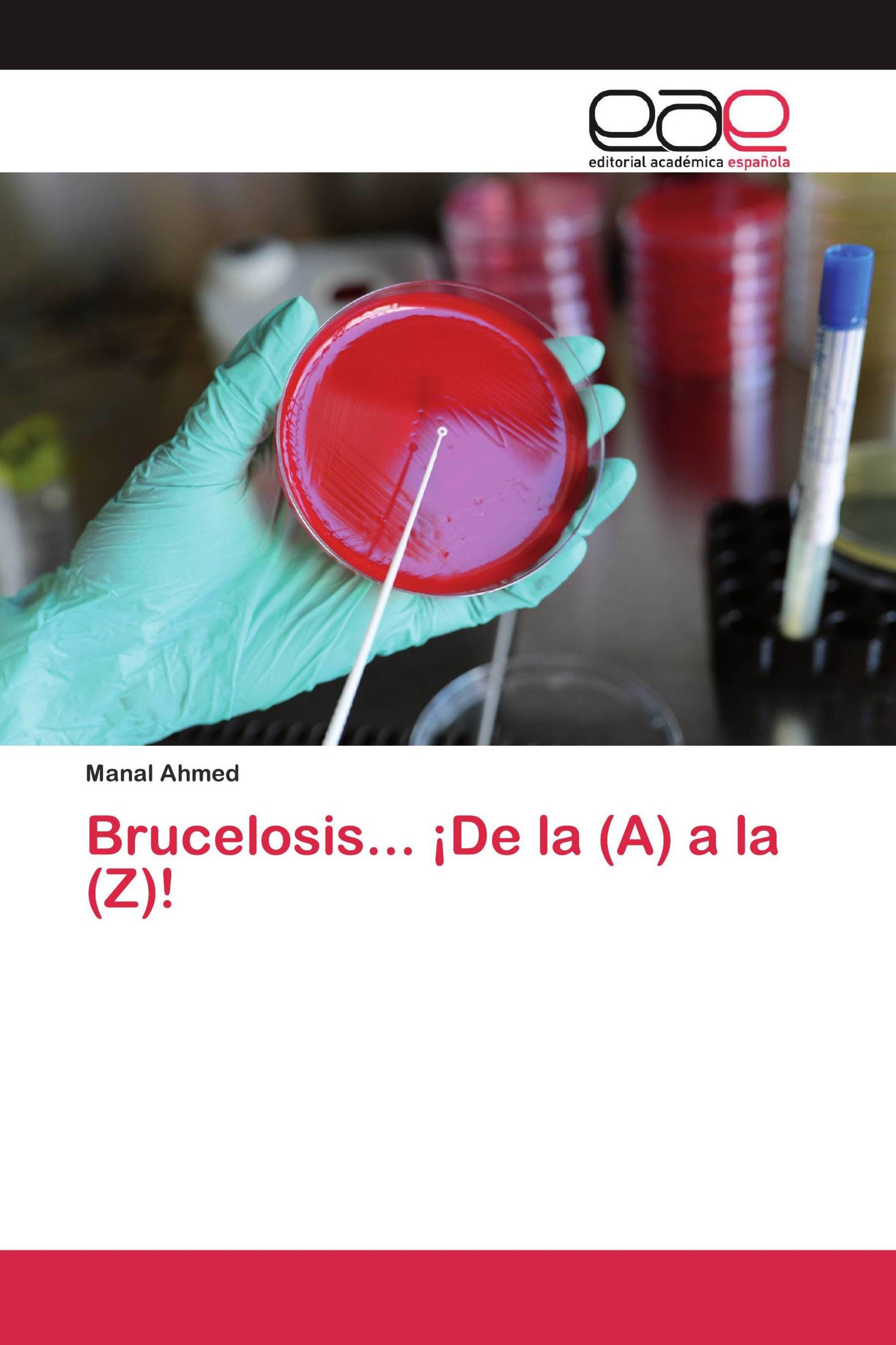 Brucelosis... ¡De la (A) a la (Z)!